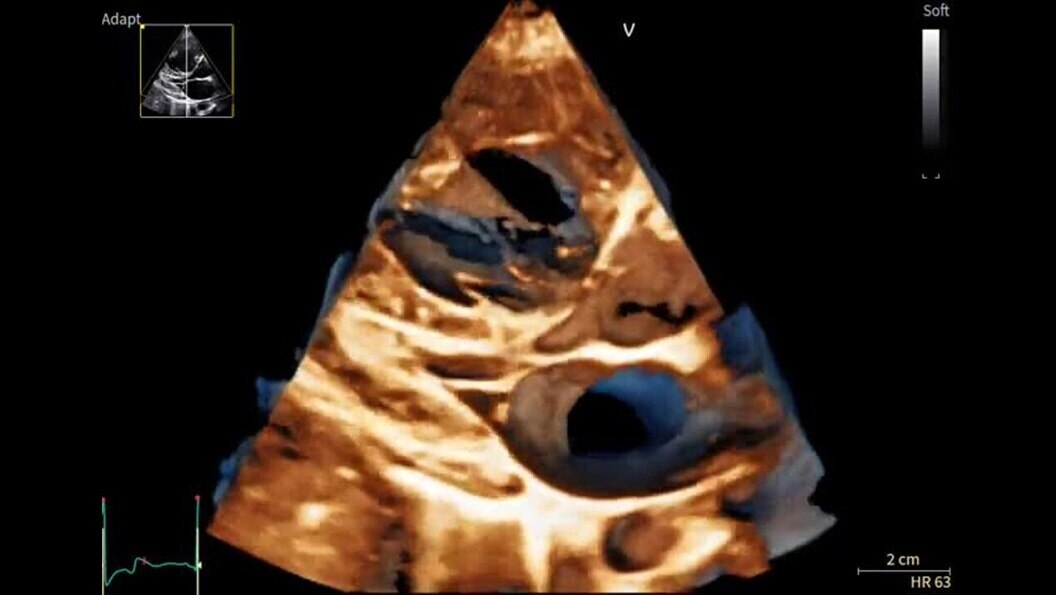 Product Media Carousel Image