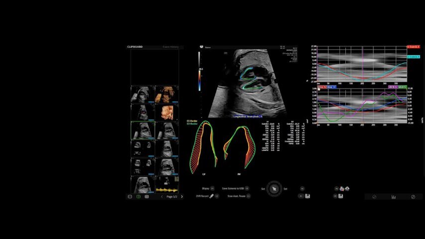 Product Media Carousel Image