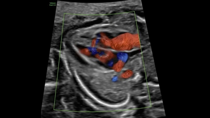 Product Media Carousel Image