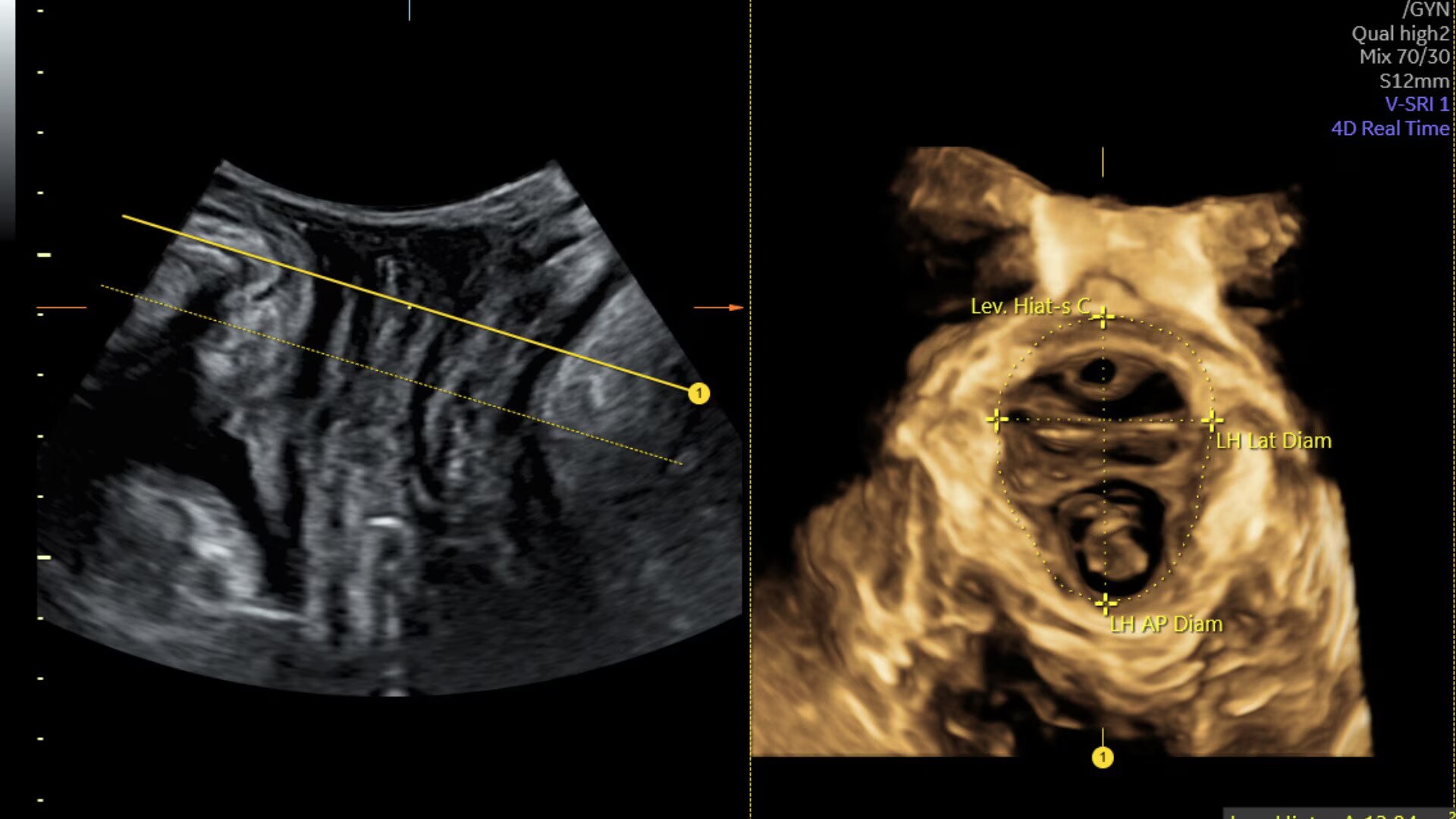 Product Media Carousel Image