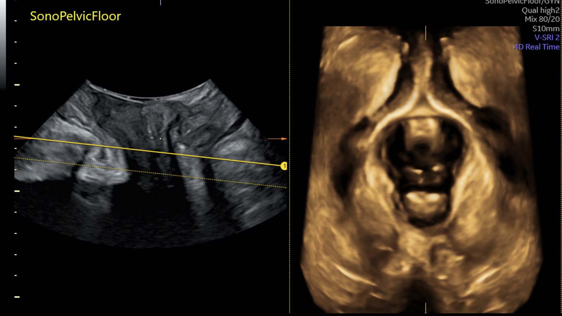 Product Media Carousel Image