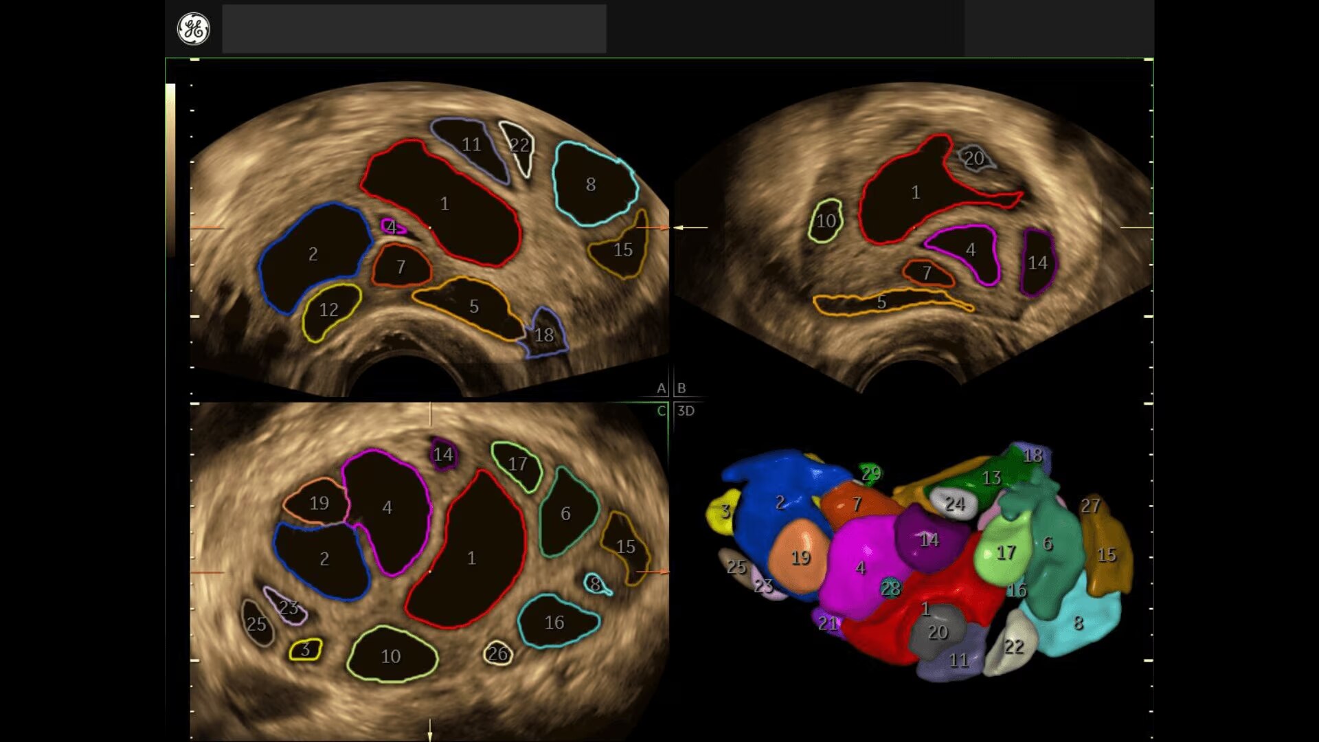 Product Media Carousel Image