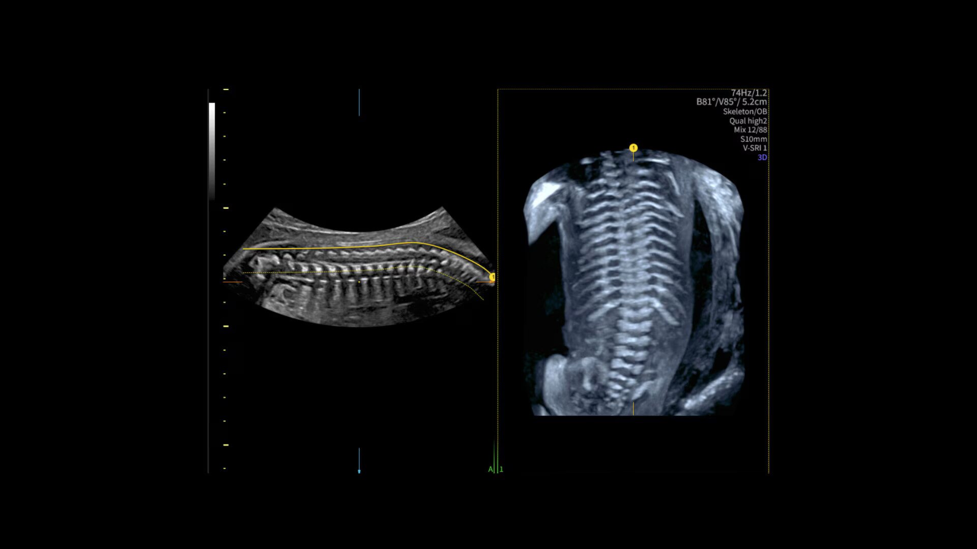 Product Media Carousel Image