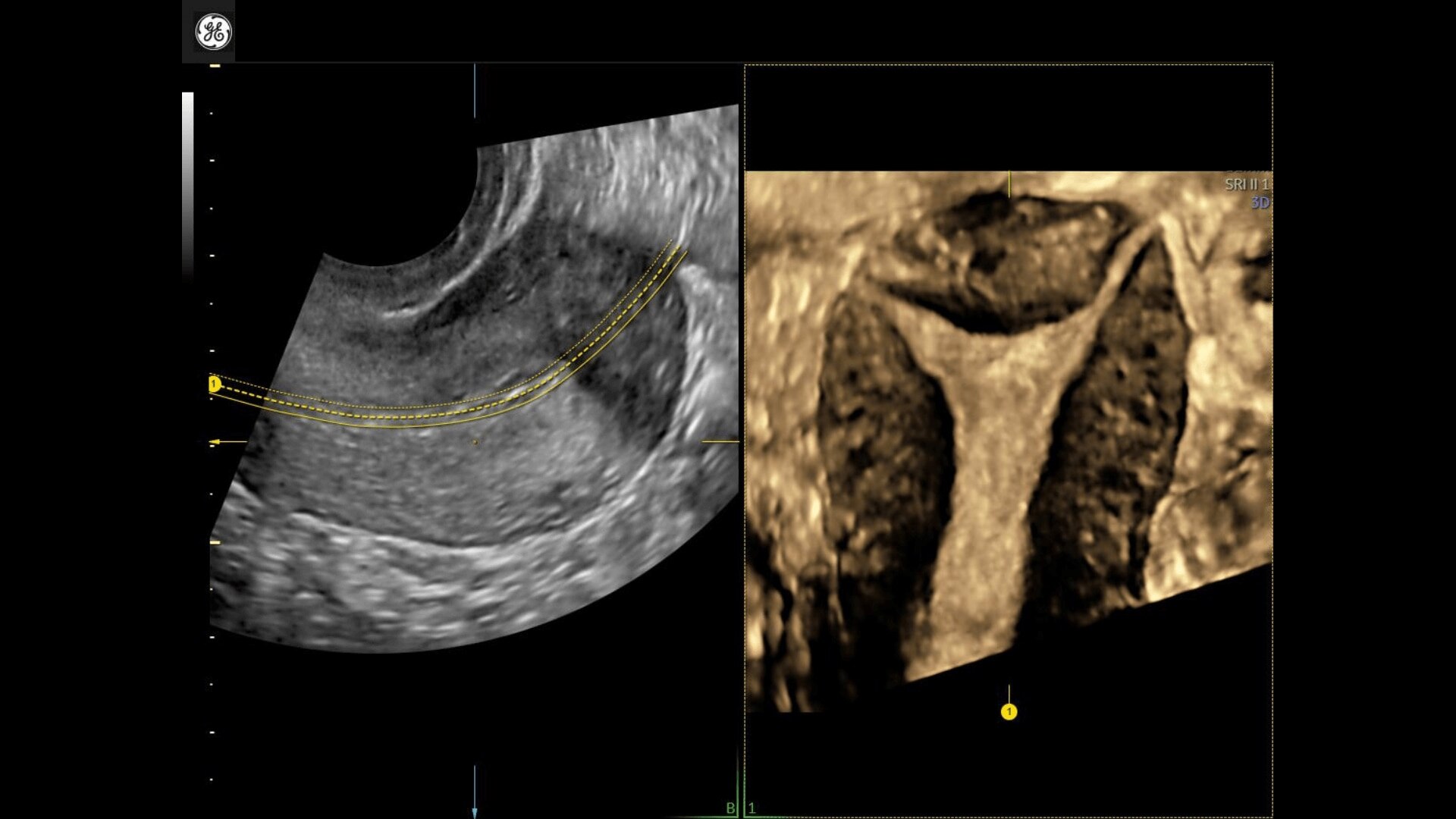 Product Media Carousel Image