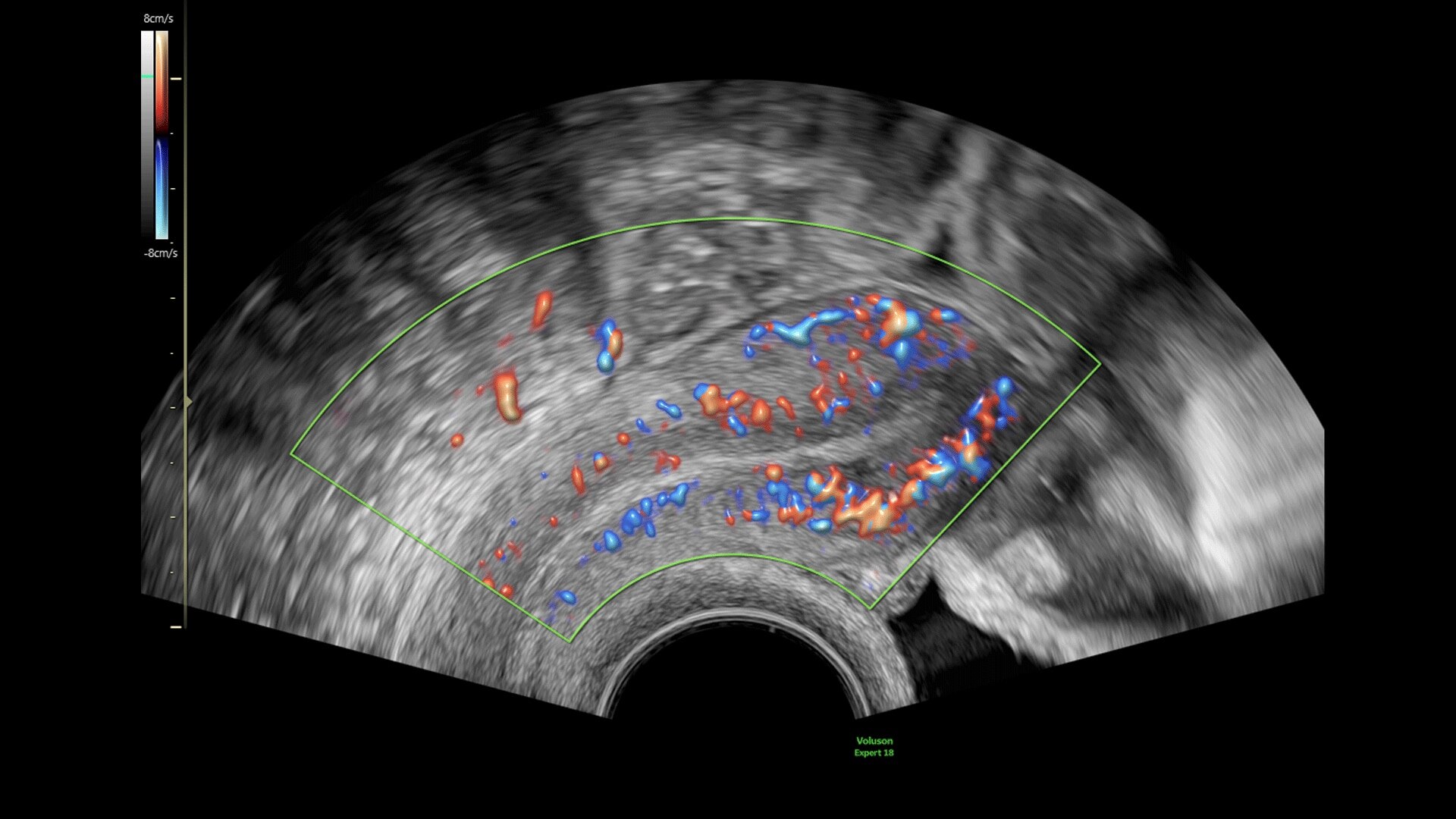 Product Media Carousel Image