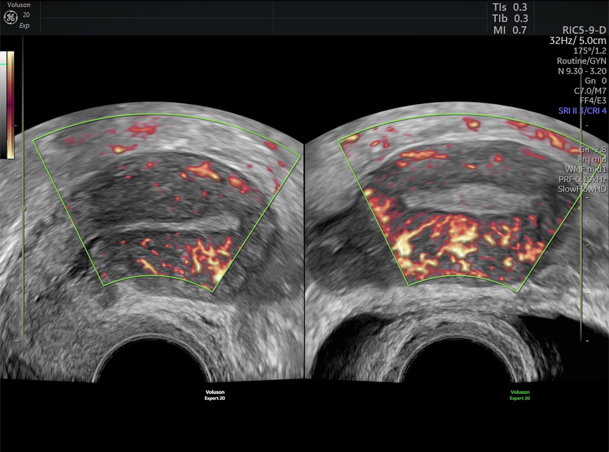 Product Media Carousel Image