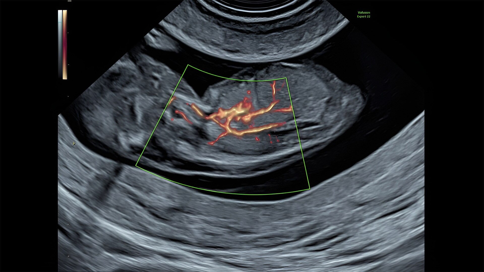 Product Media Carousel Image