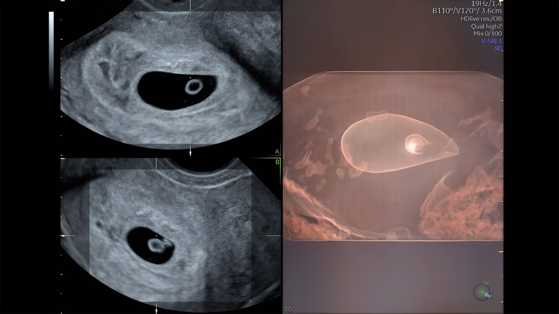 Product Media Carousel Image