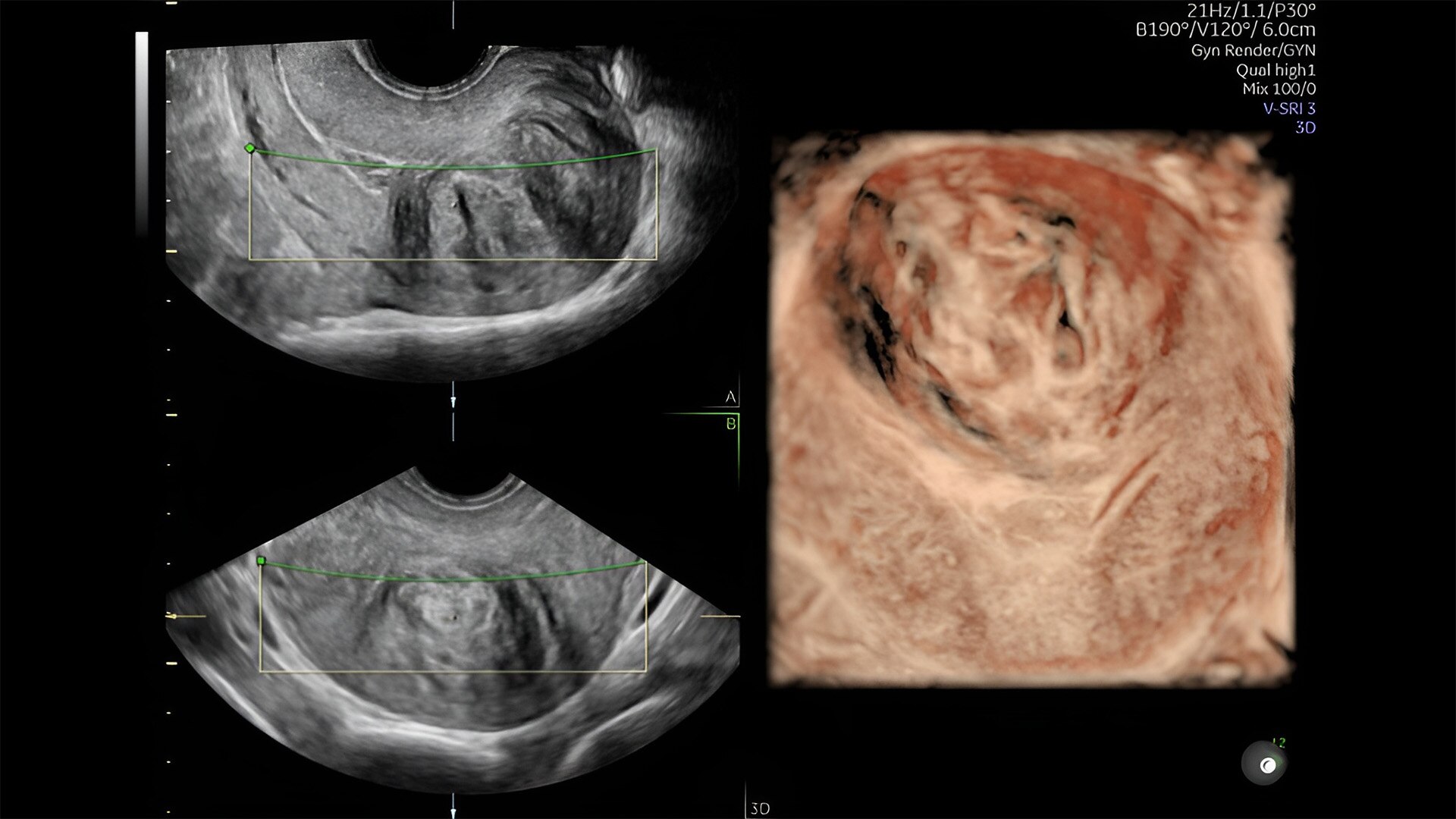 Product Media Carousel Image