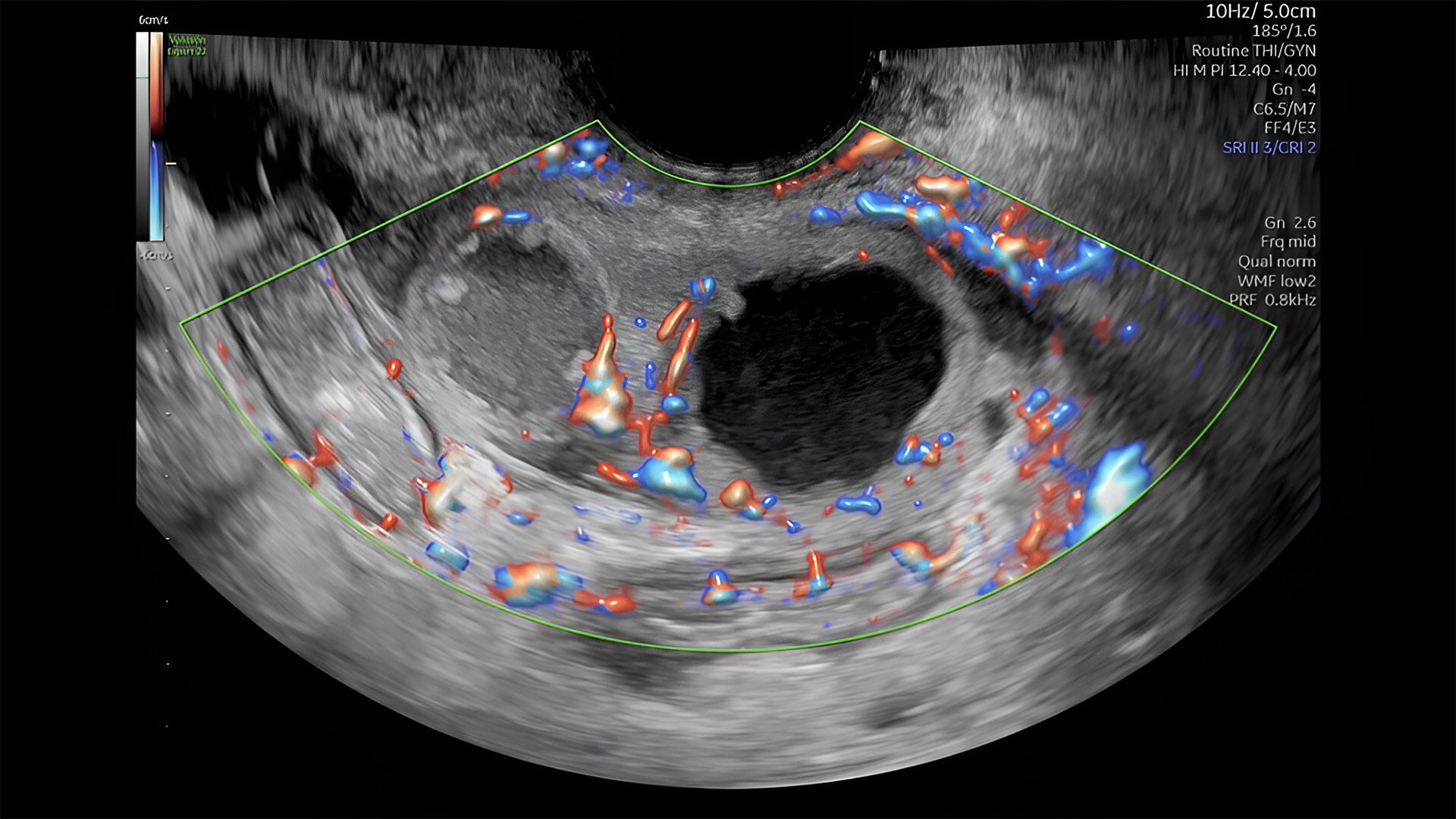 Product Media Carousel Image