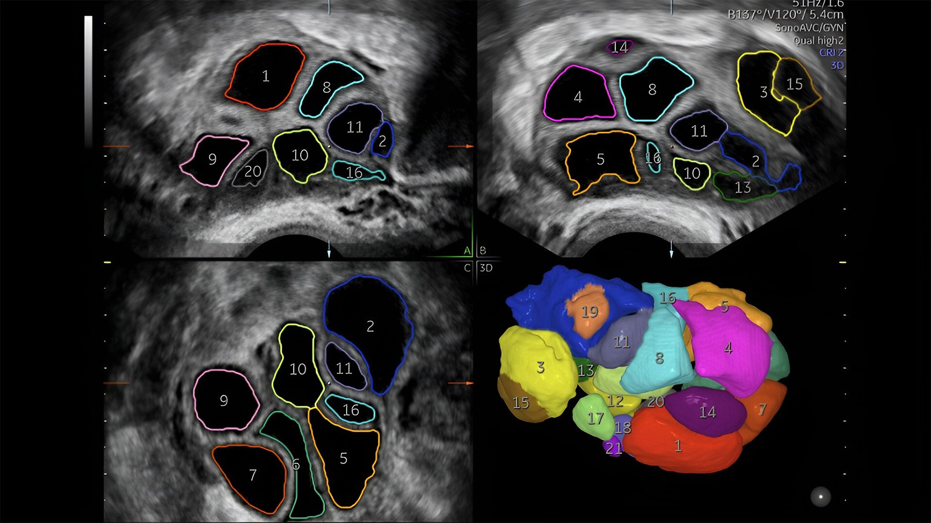 Product Media Carousel Image