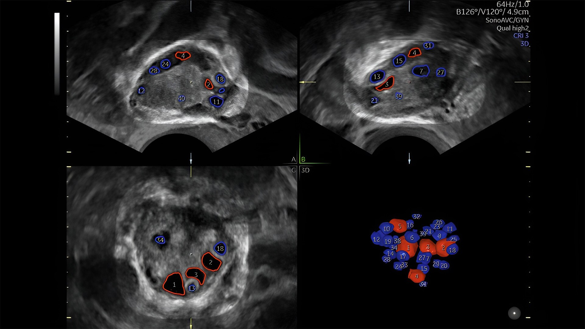 Product Media Carousel Image