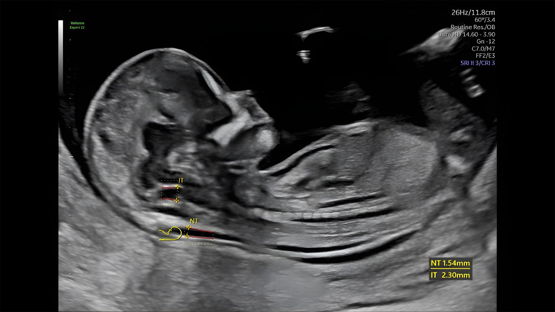 Product Media Carousel Image