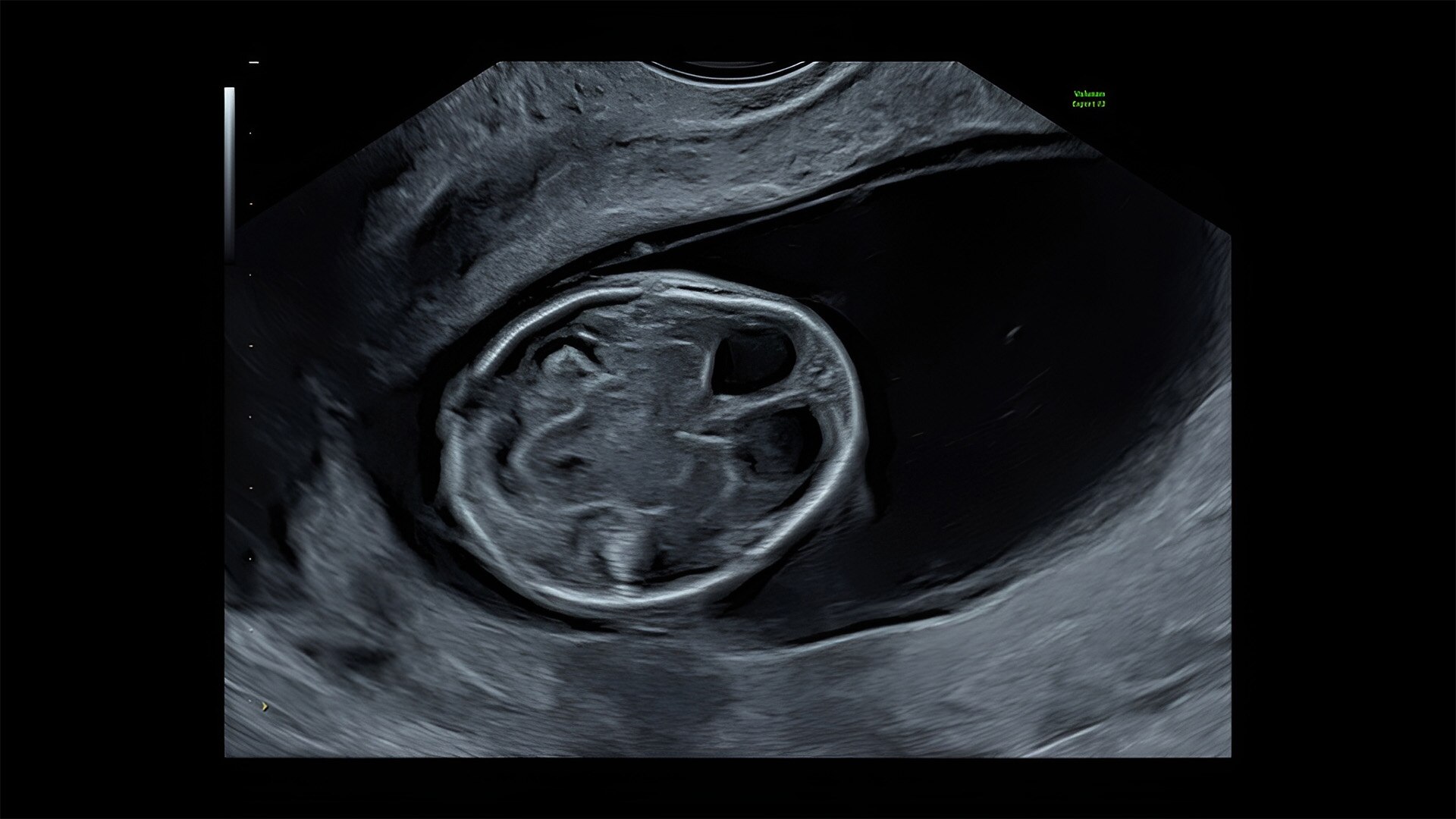 Product Media Carousel Image