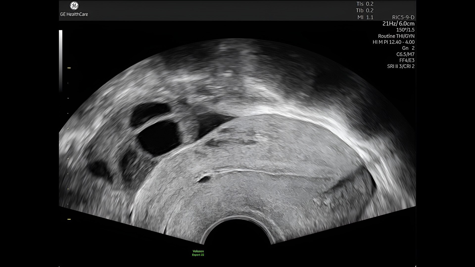 Product Media Carousel Image