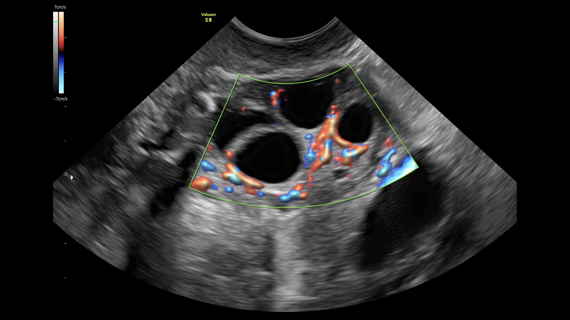 Product Media Carousel Image