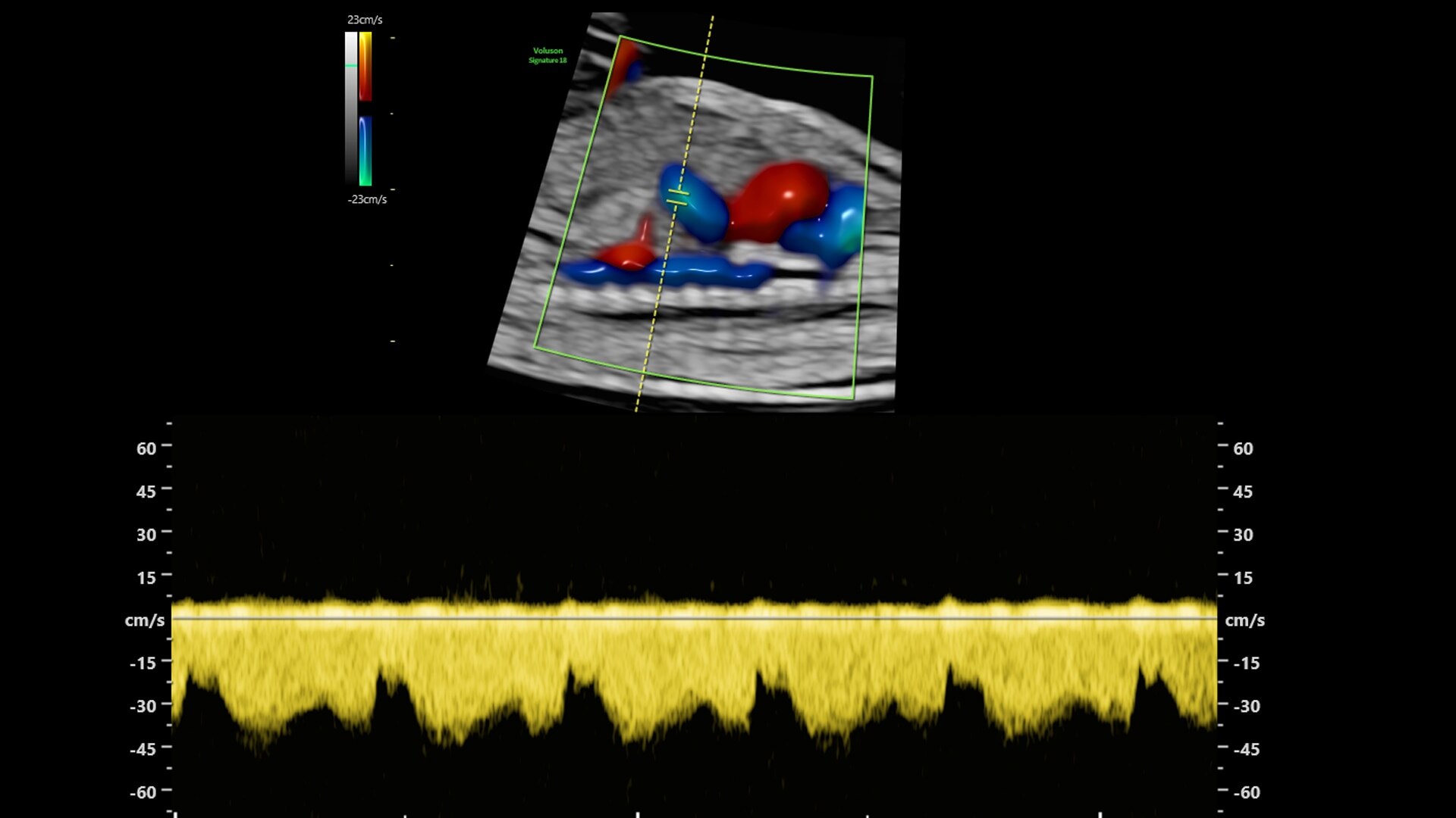 Product Media Carousel Image
