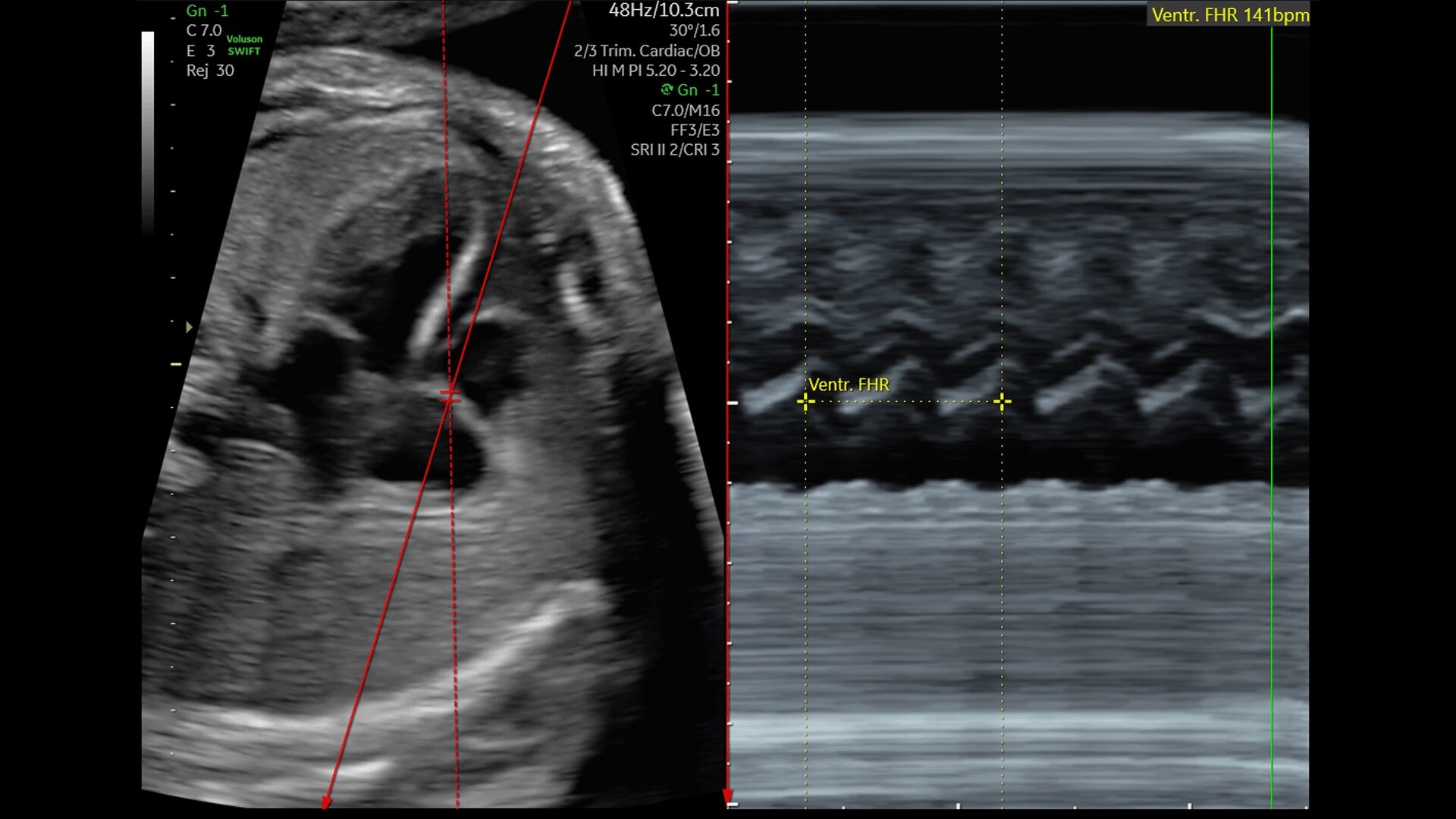 Product Media Carousel Image