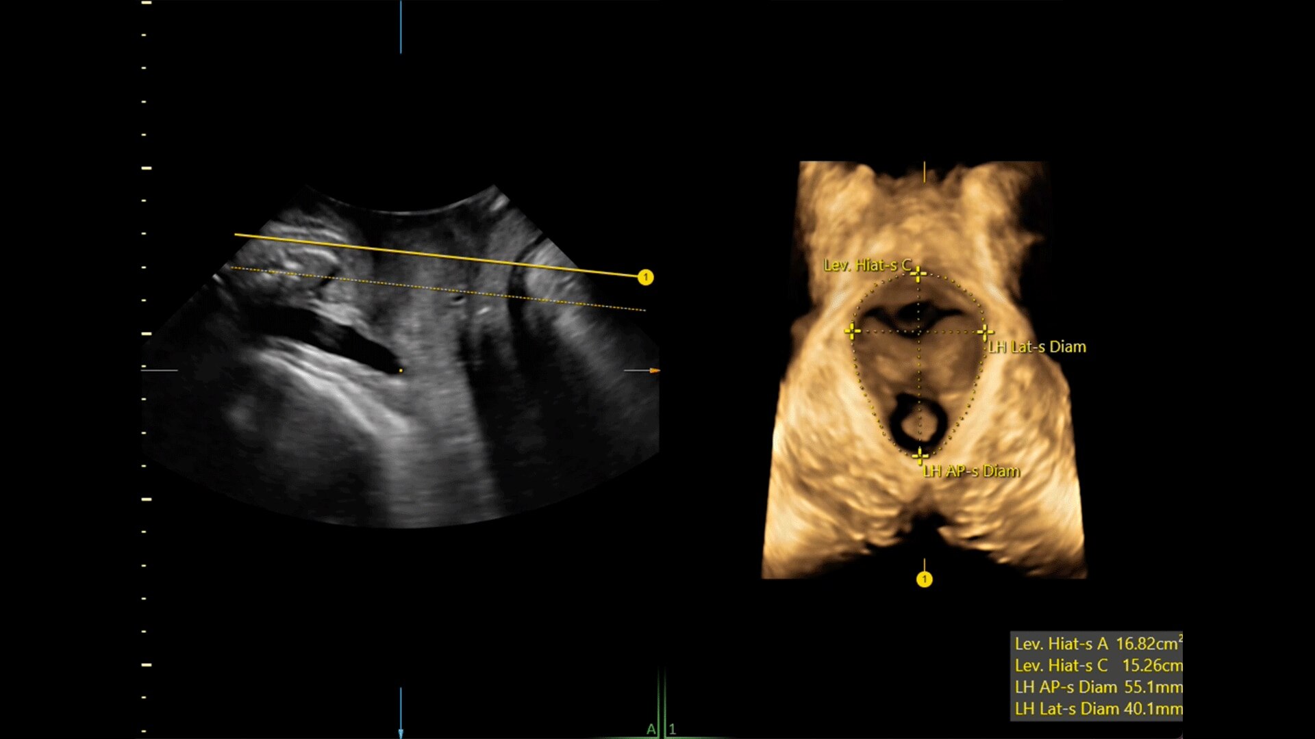 Product Media Carousel Image