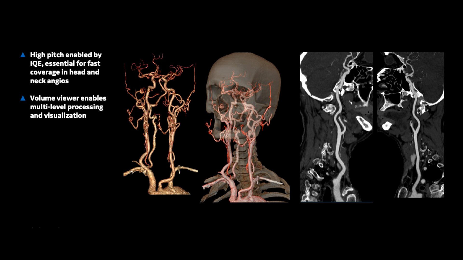 Product Media Carousel Image