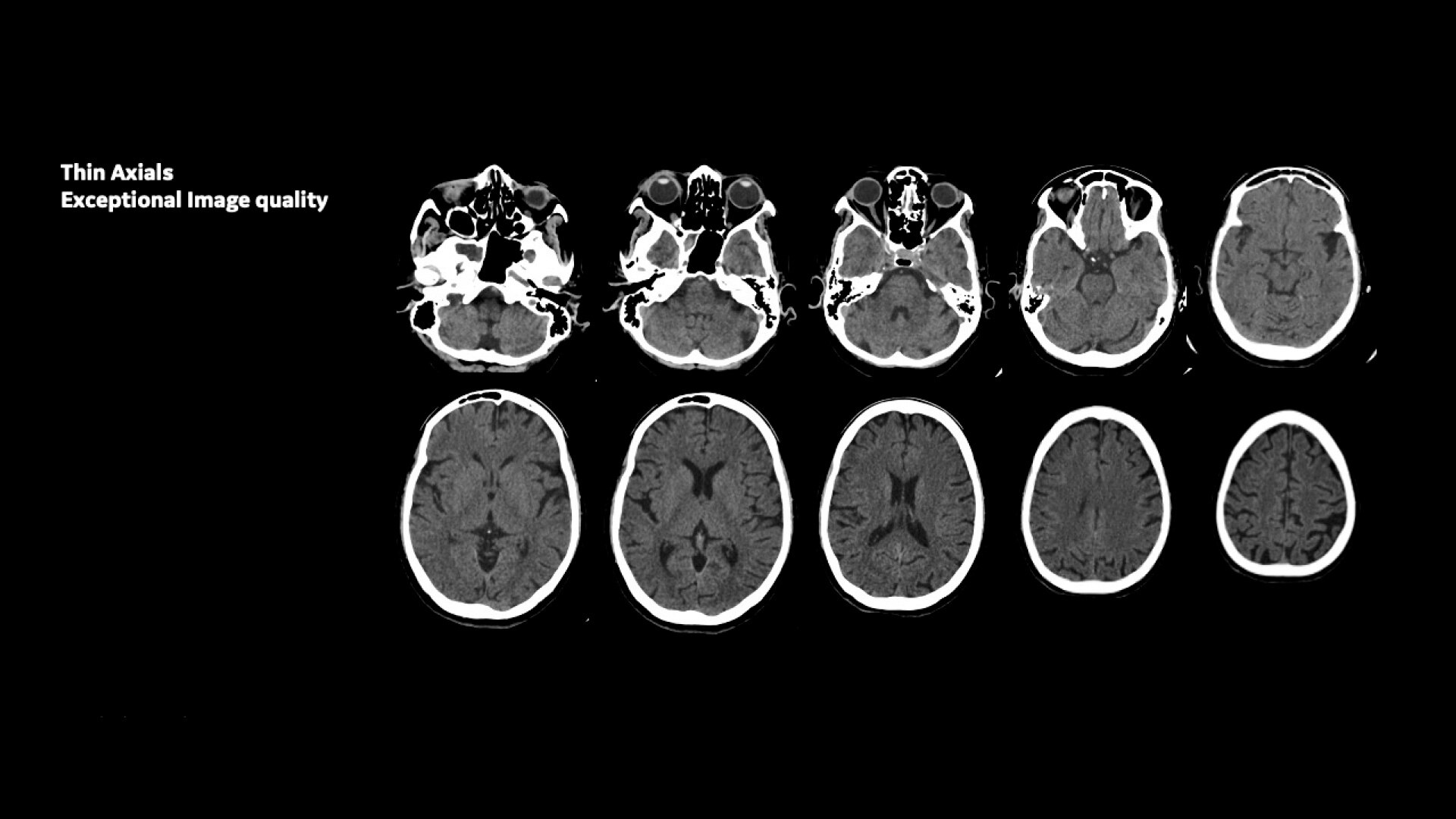 Product Media Carousel Image