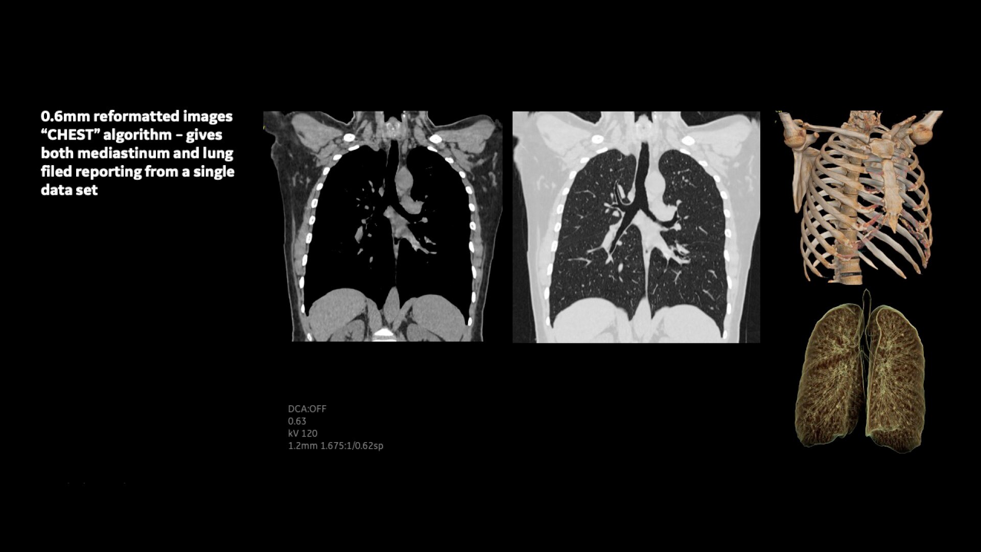 Product Media Carousel Image
