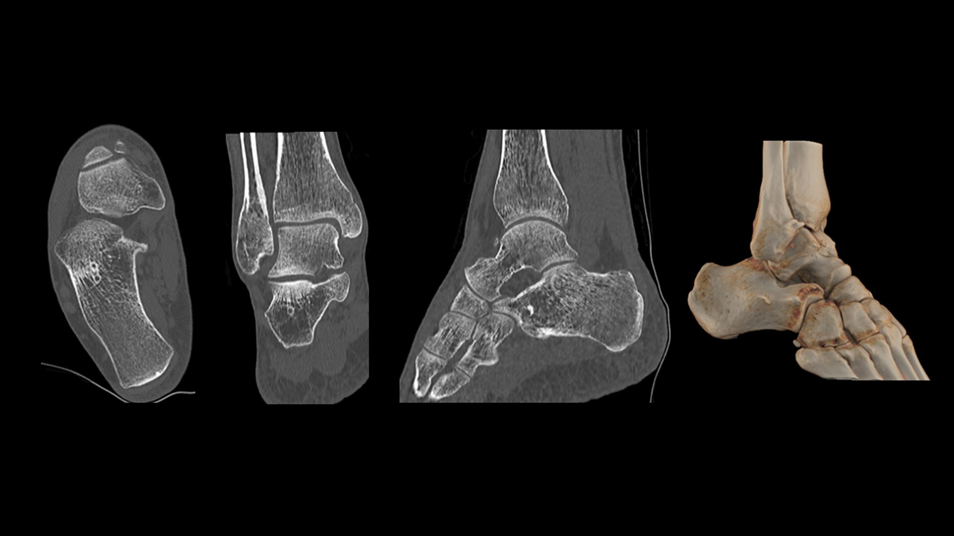 Product Media Carousel Image