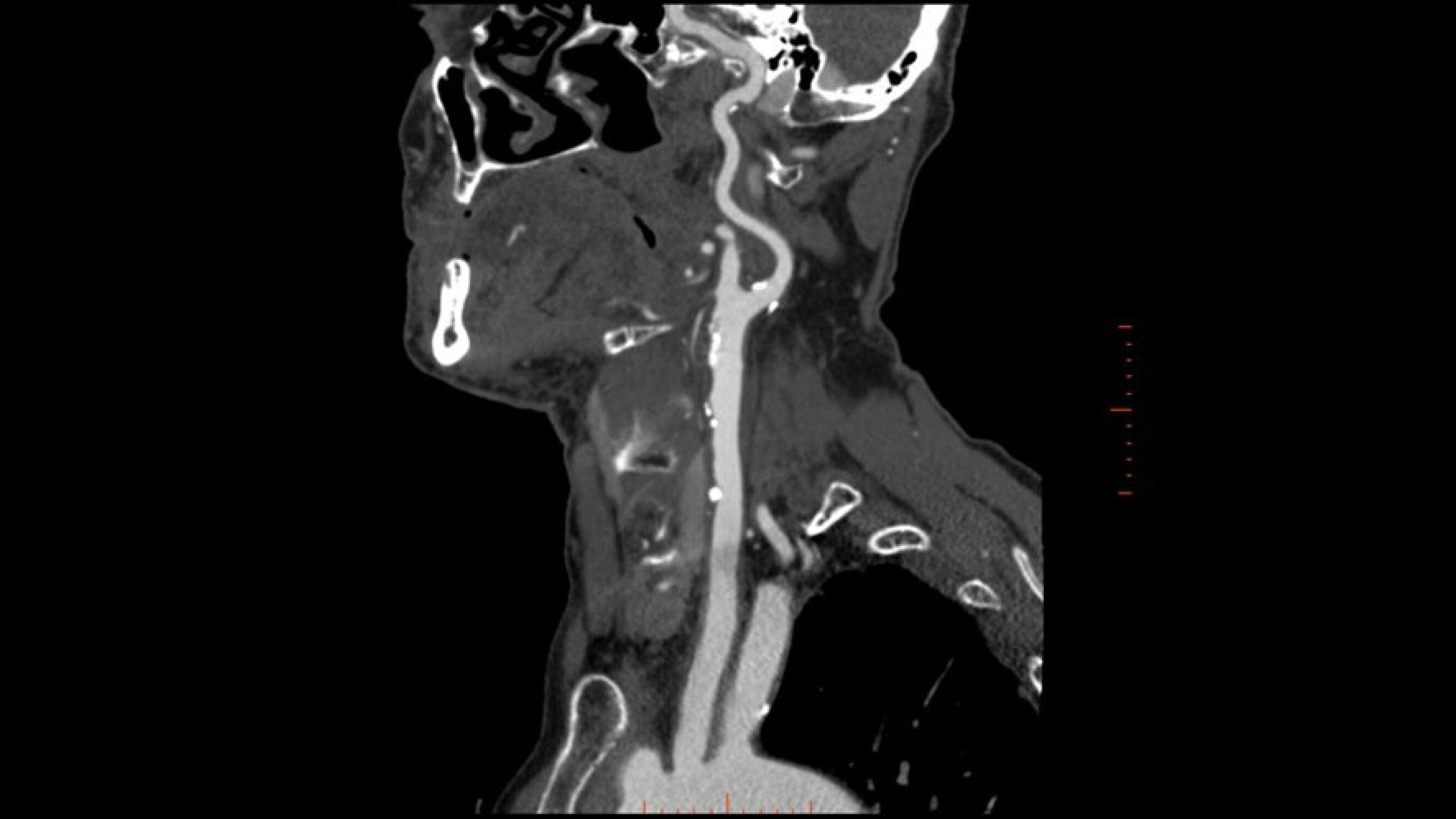 Product Media Carousel Image