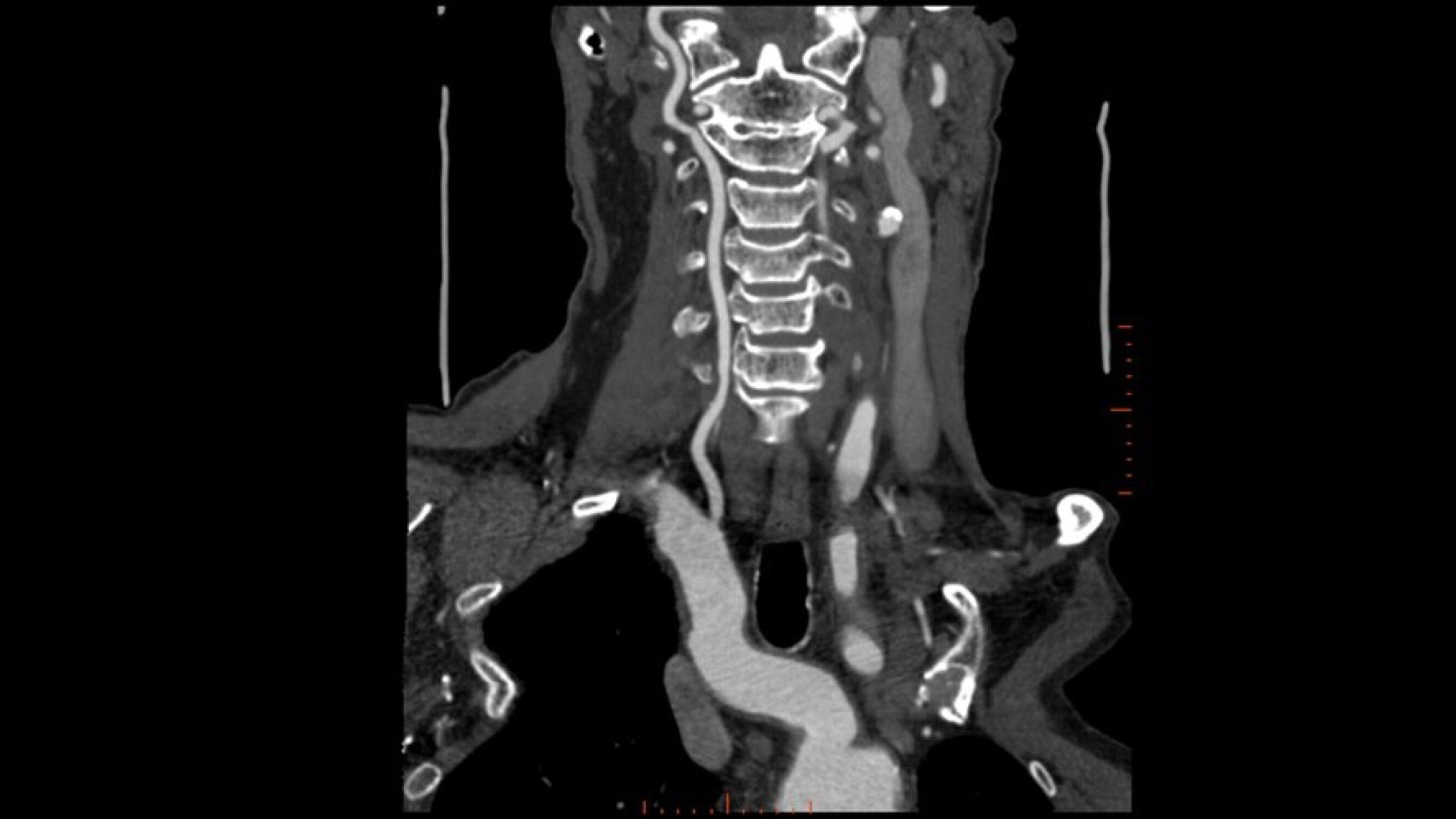 Product Media Carousel Image