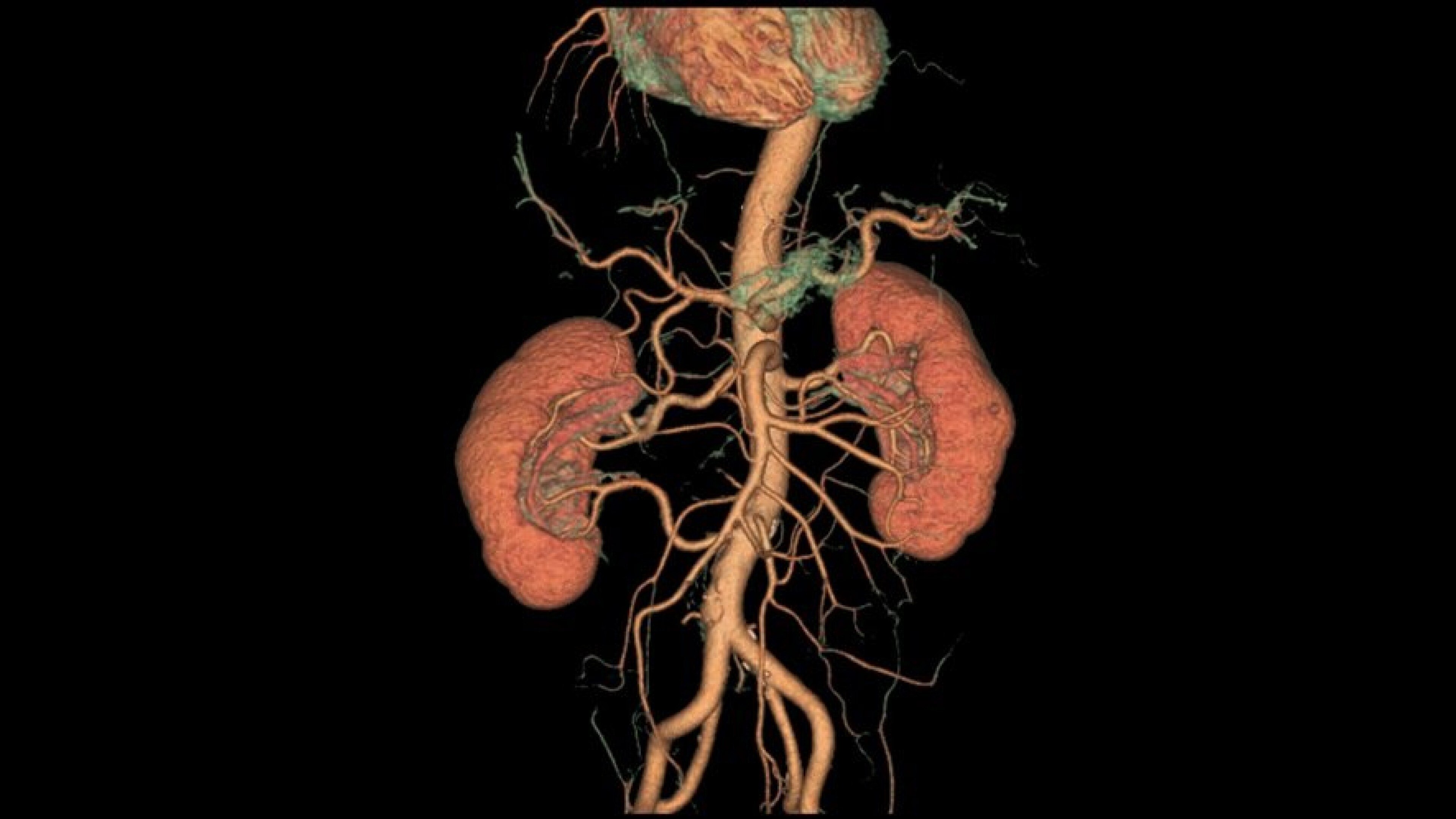 Product Media Carousel Image