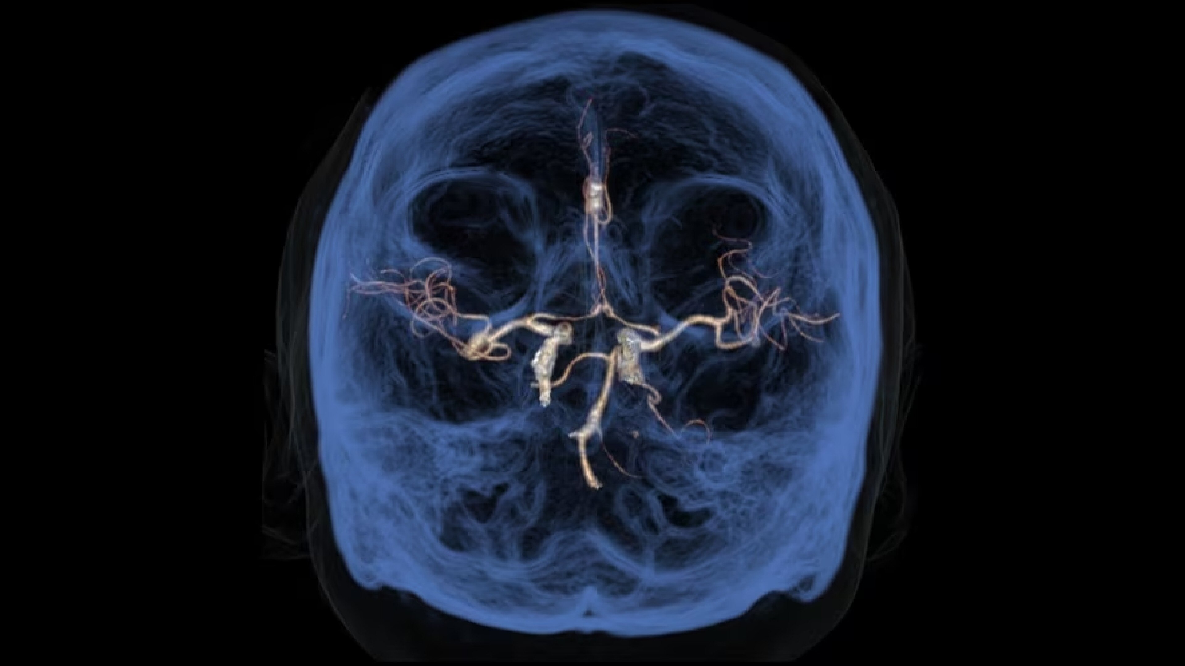 Product Media Carousel Image