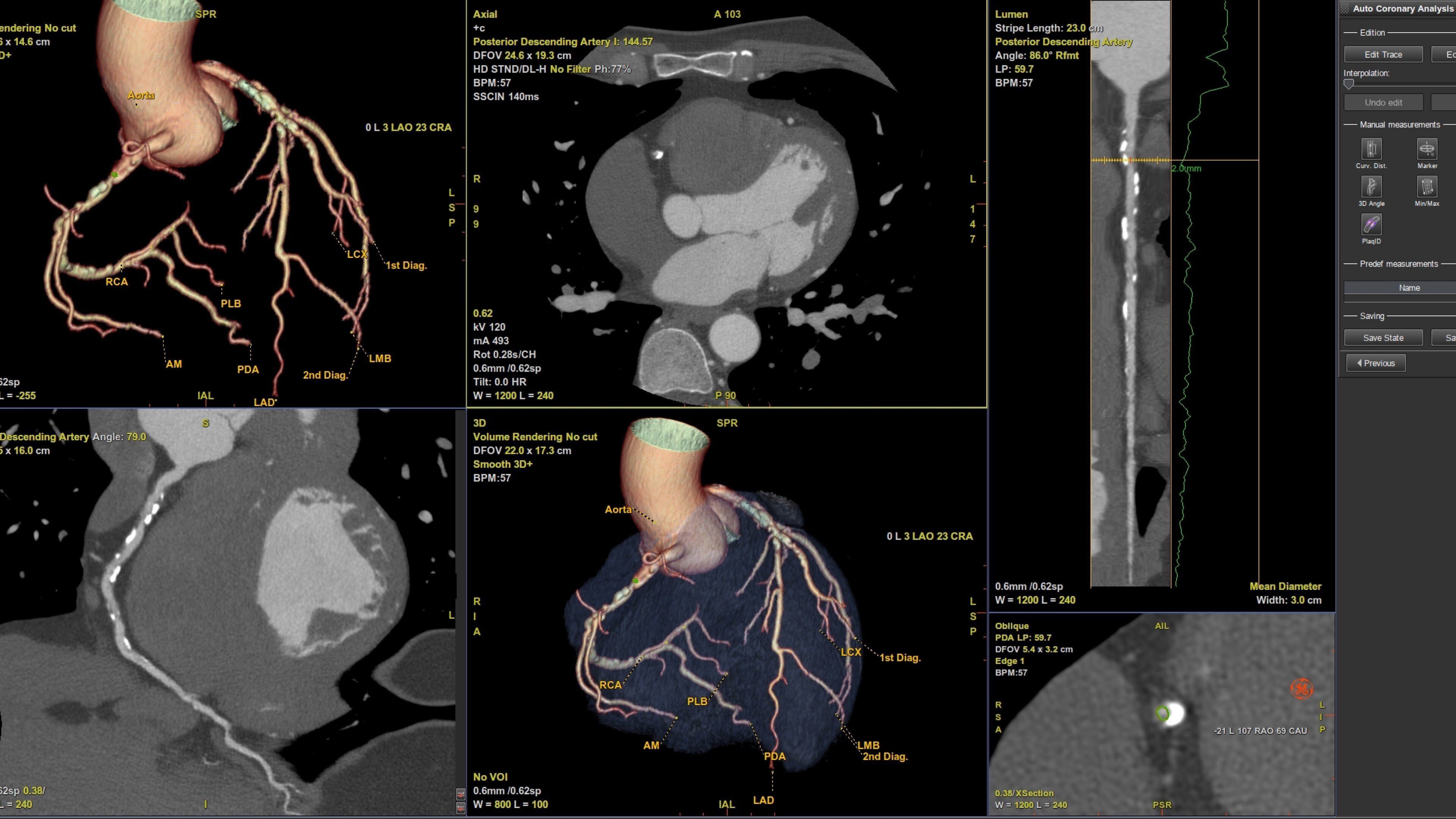Product Media Carousel Image