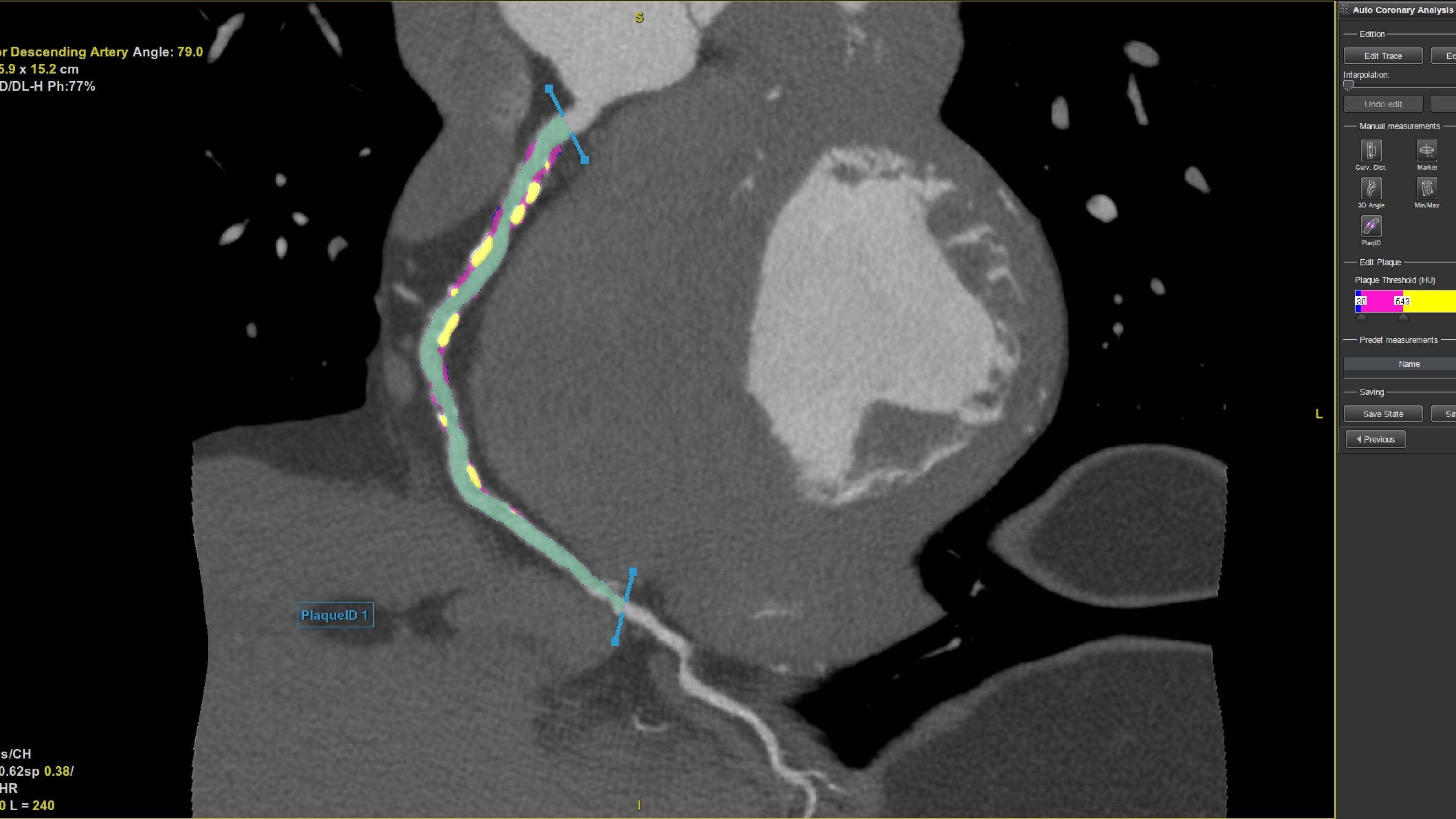 Product Media Carousel Image