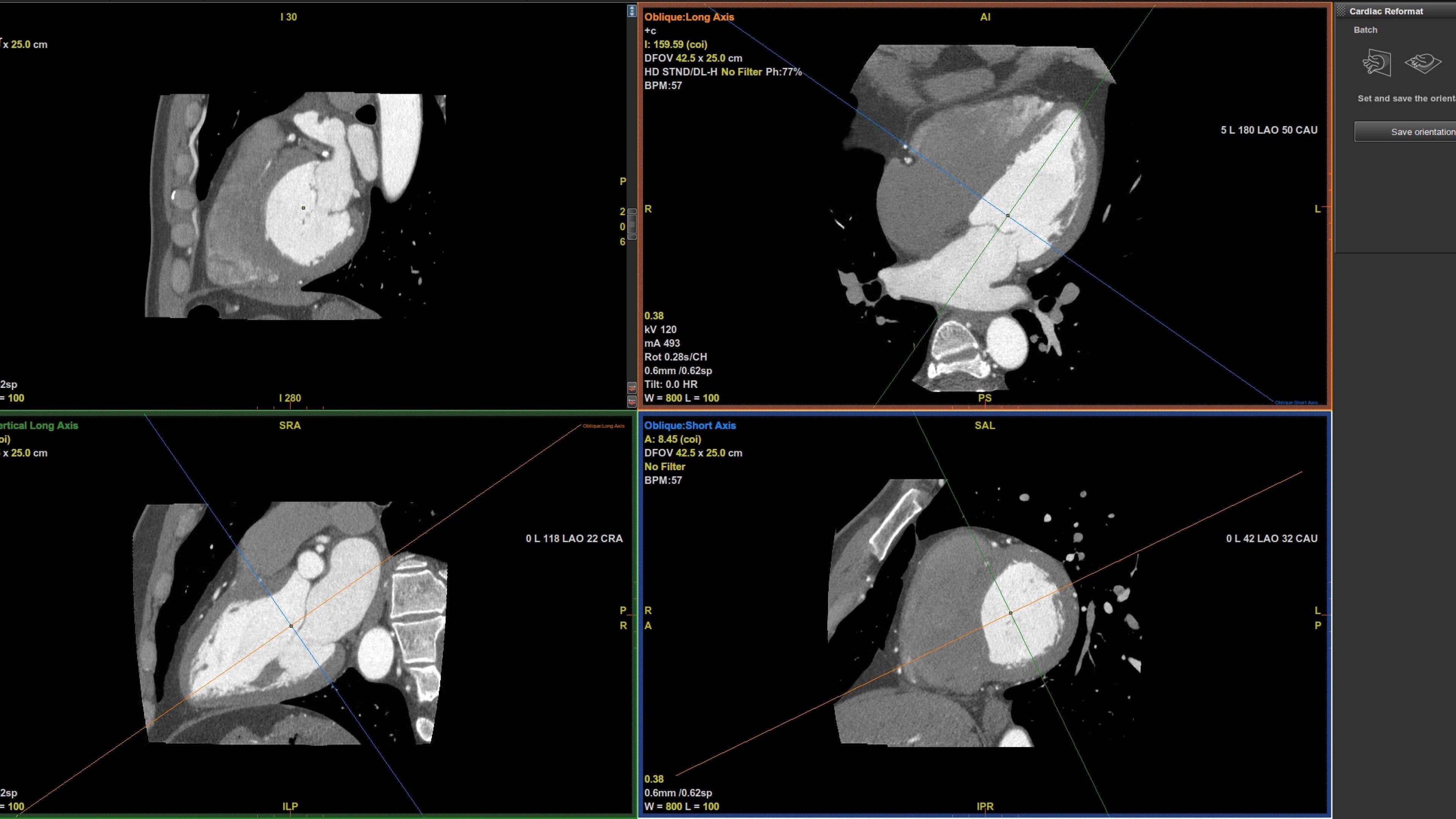 Product Media Carousel Image