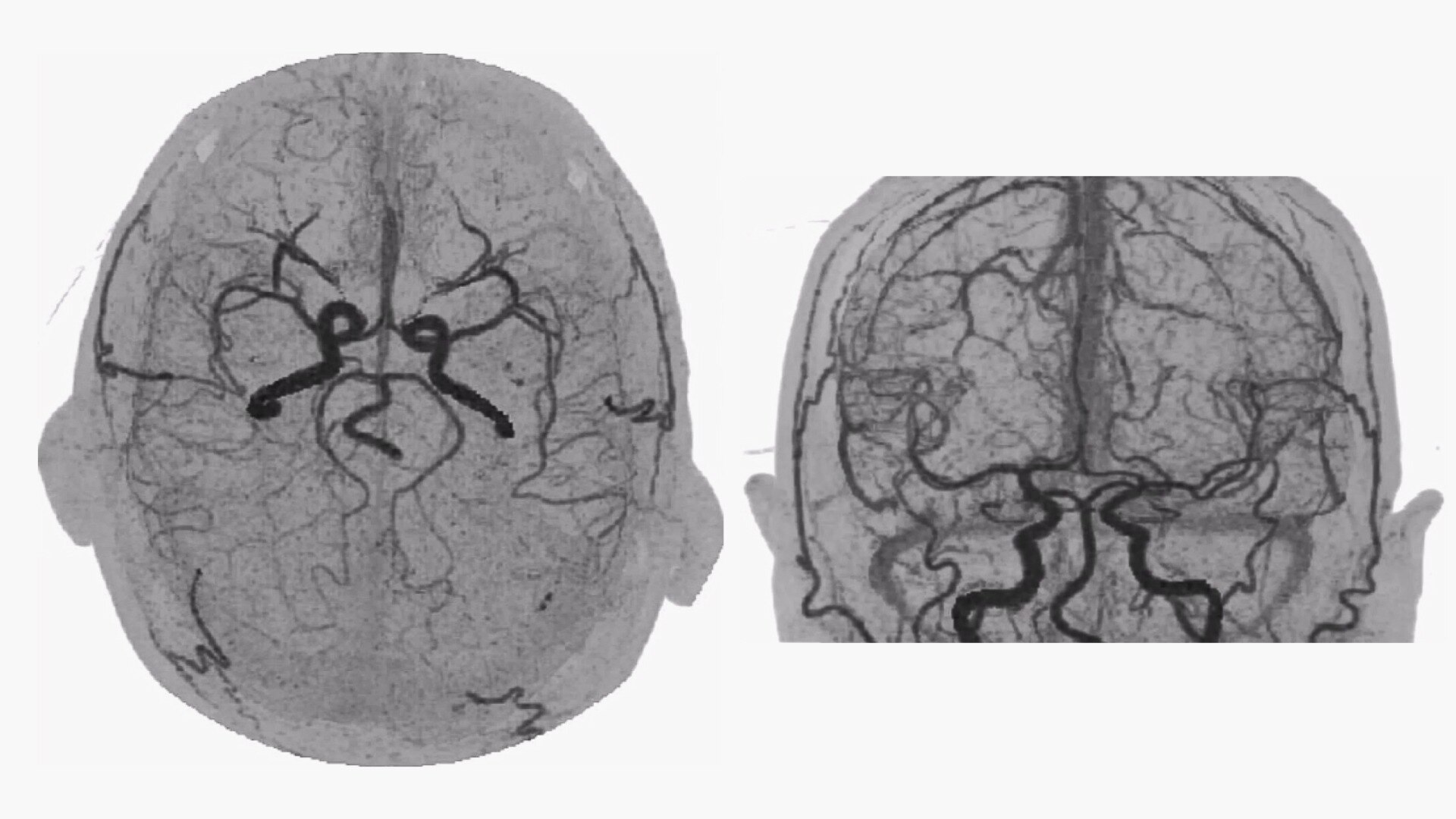 Product Media Carousel Image