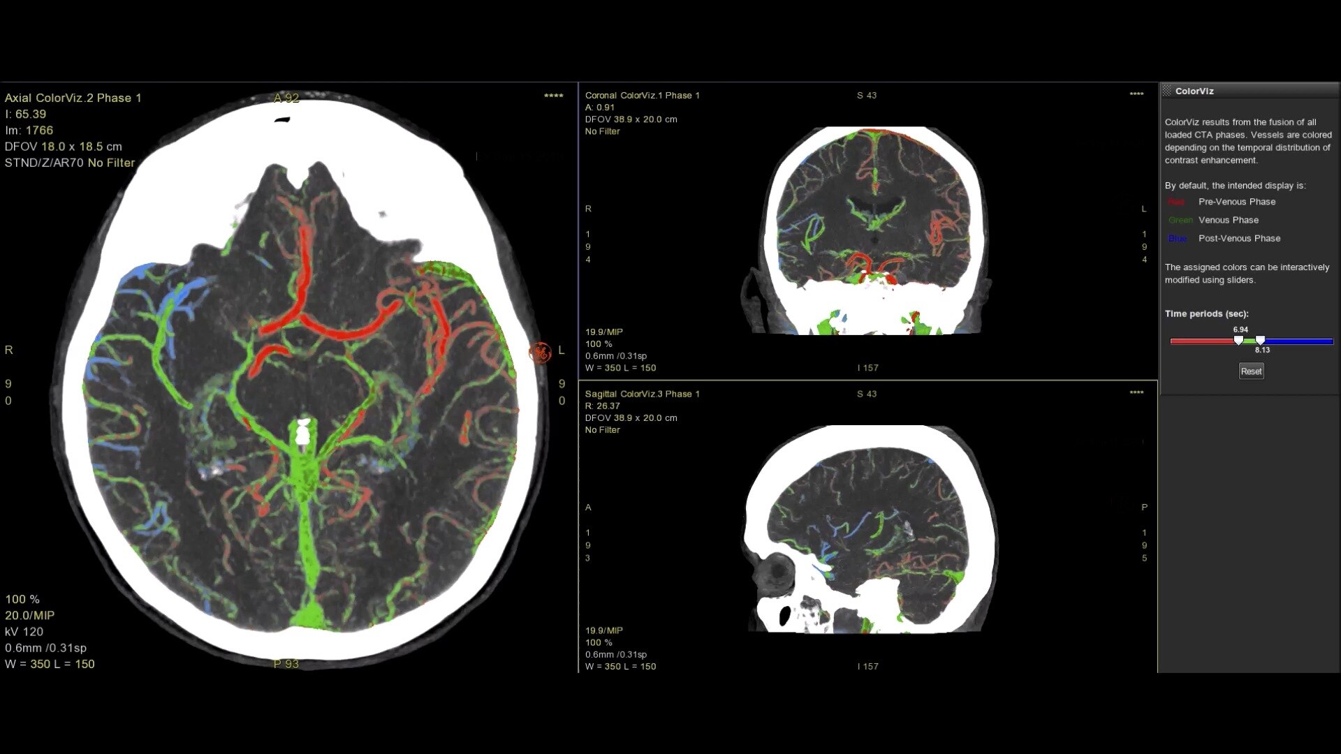 Product Media Carousel Image