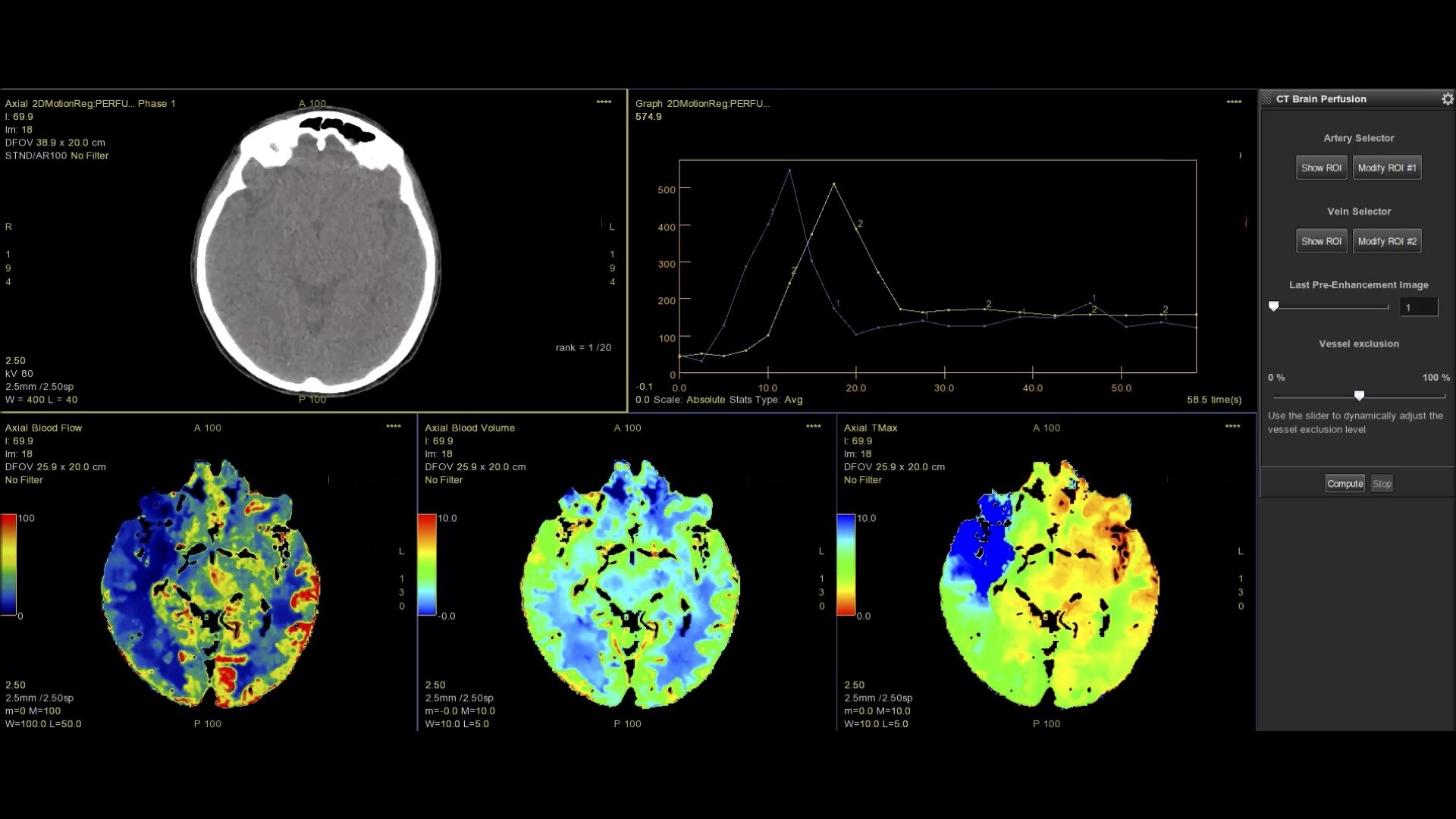 Product Media Carousel Image