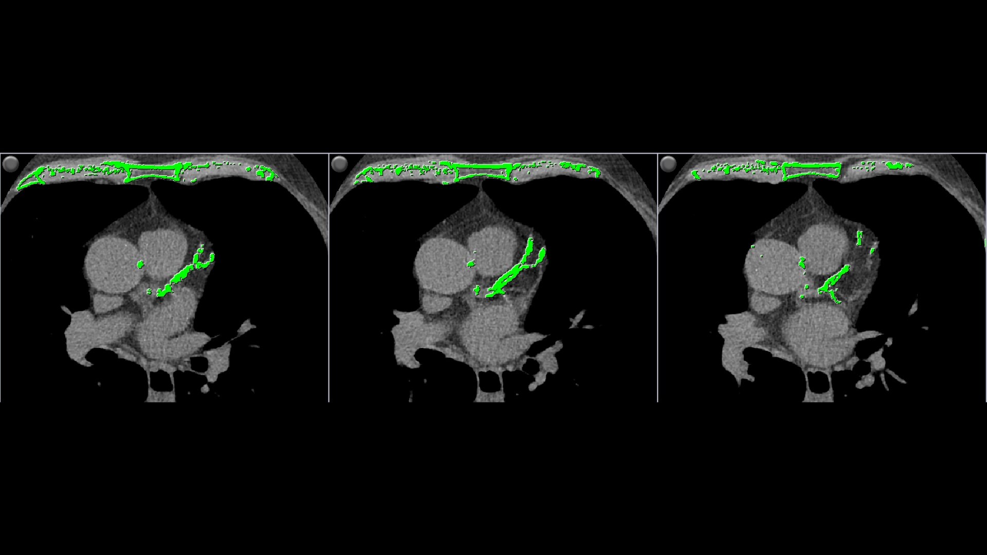 Product Media Carousel Image