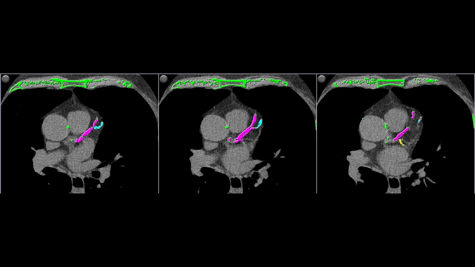 Product Media Carousel Image