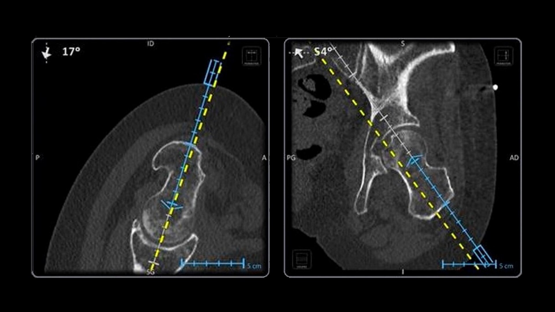 Product Media Carousel Image