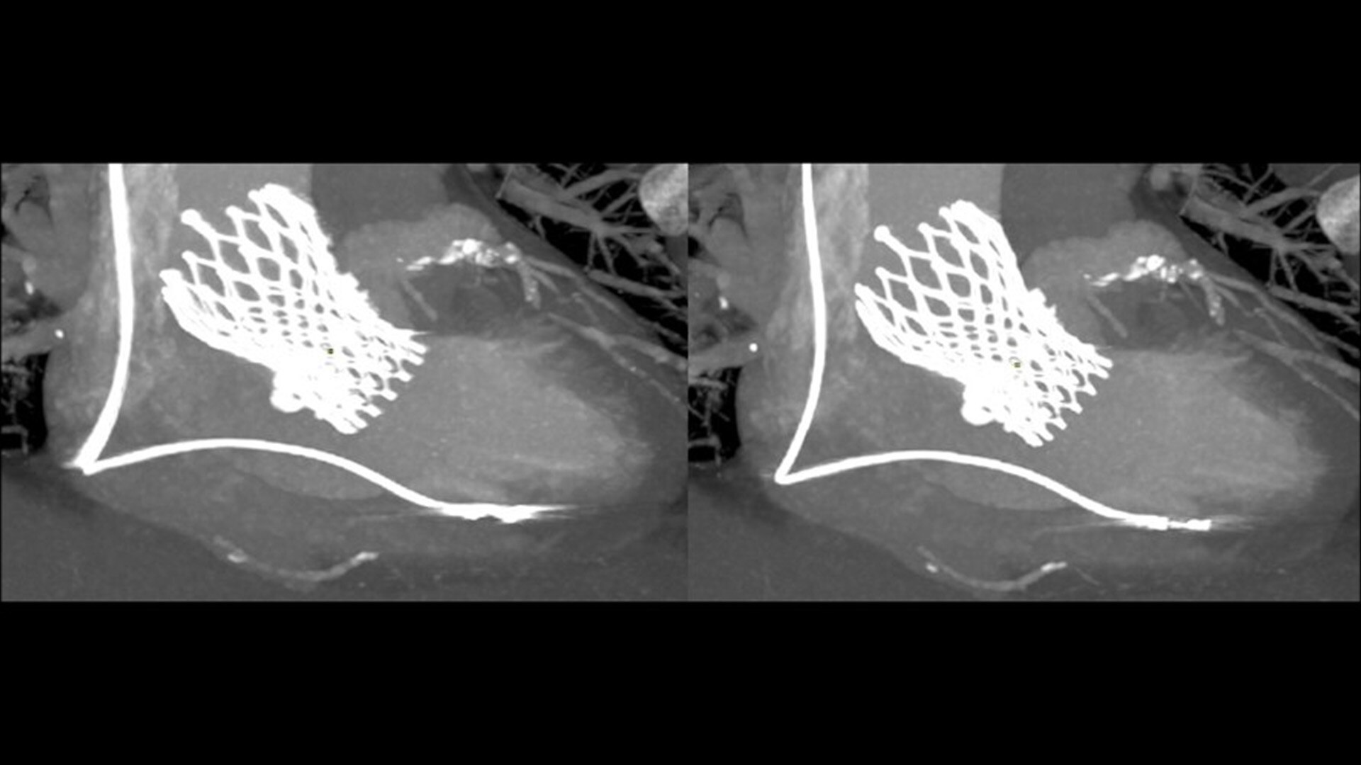 Product Media Carousel Image