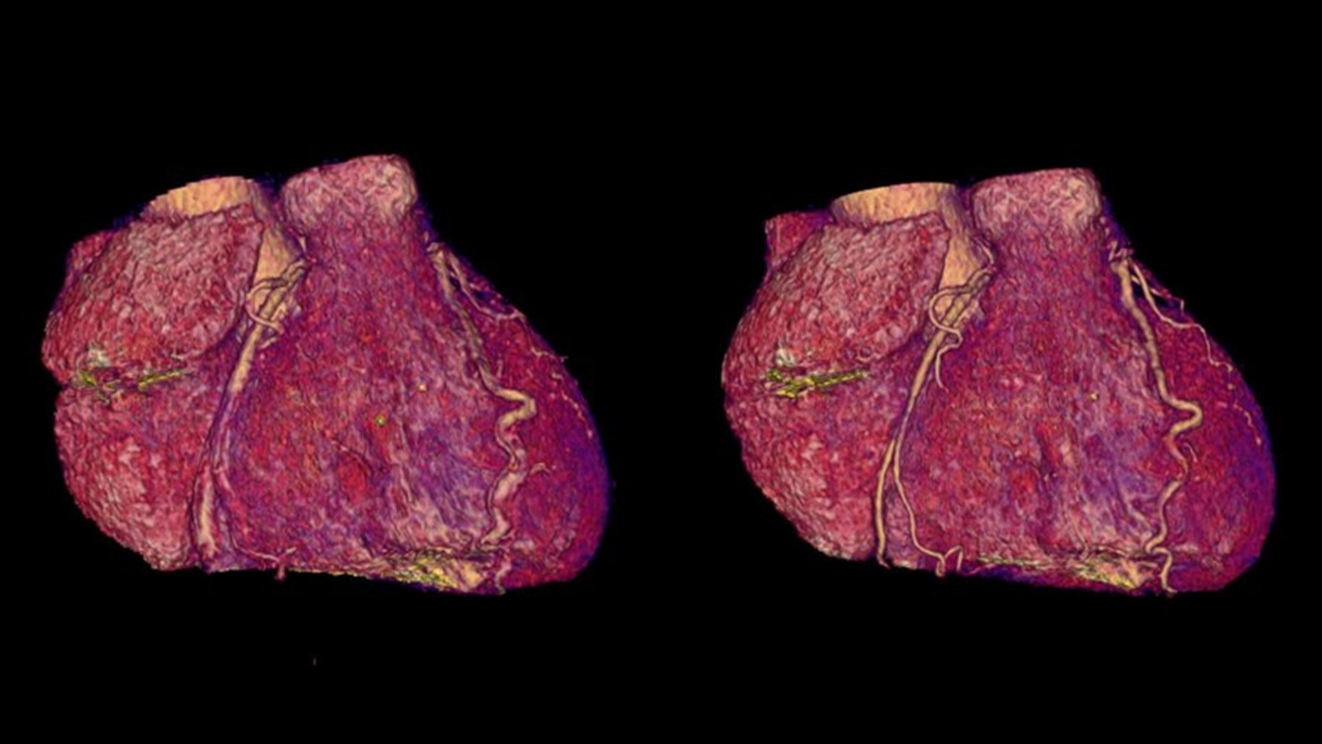 Product Media Carousel Image