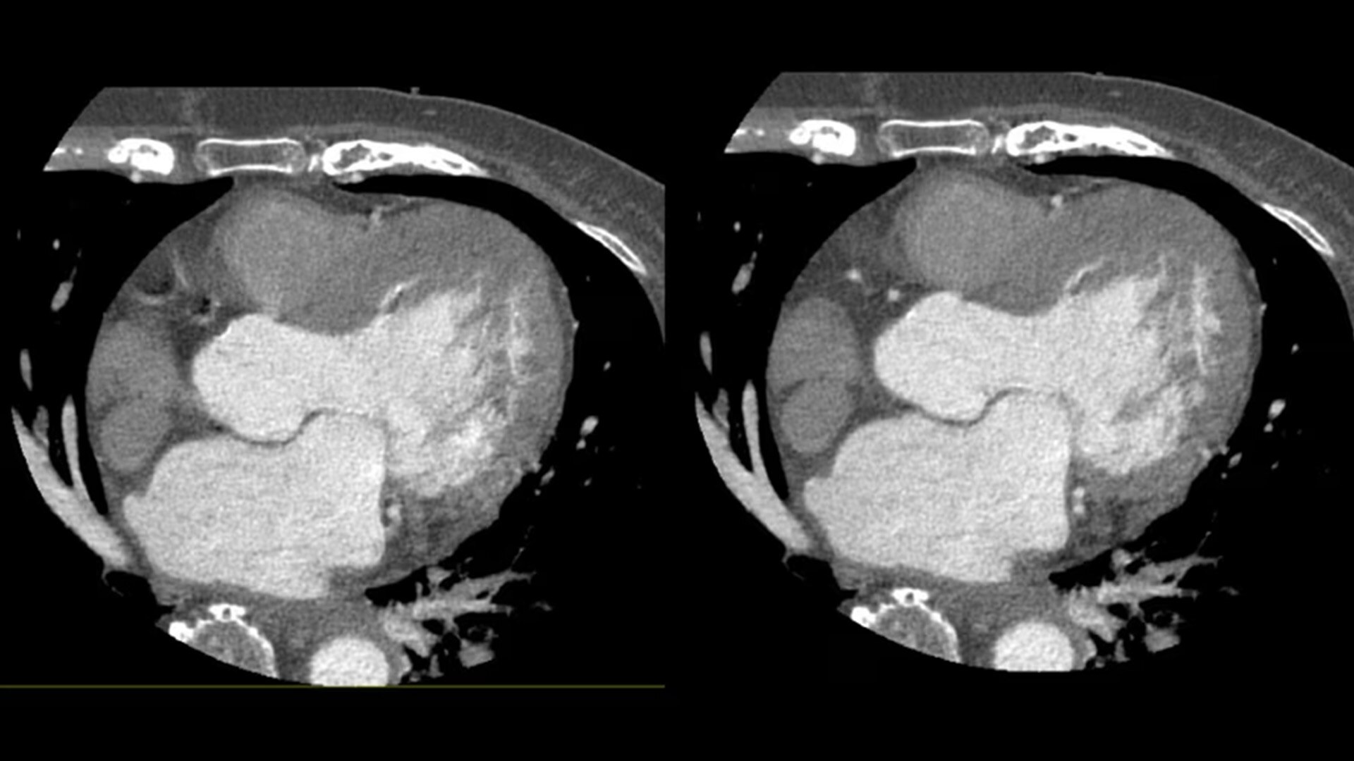 Product Media Carousel Image