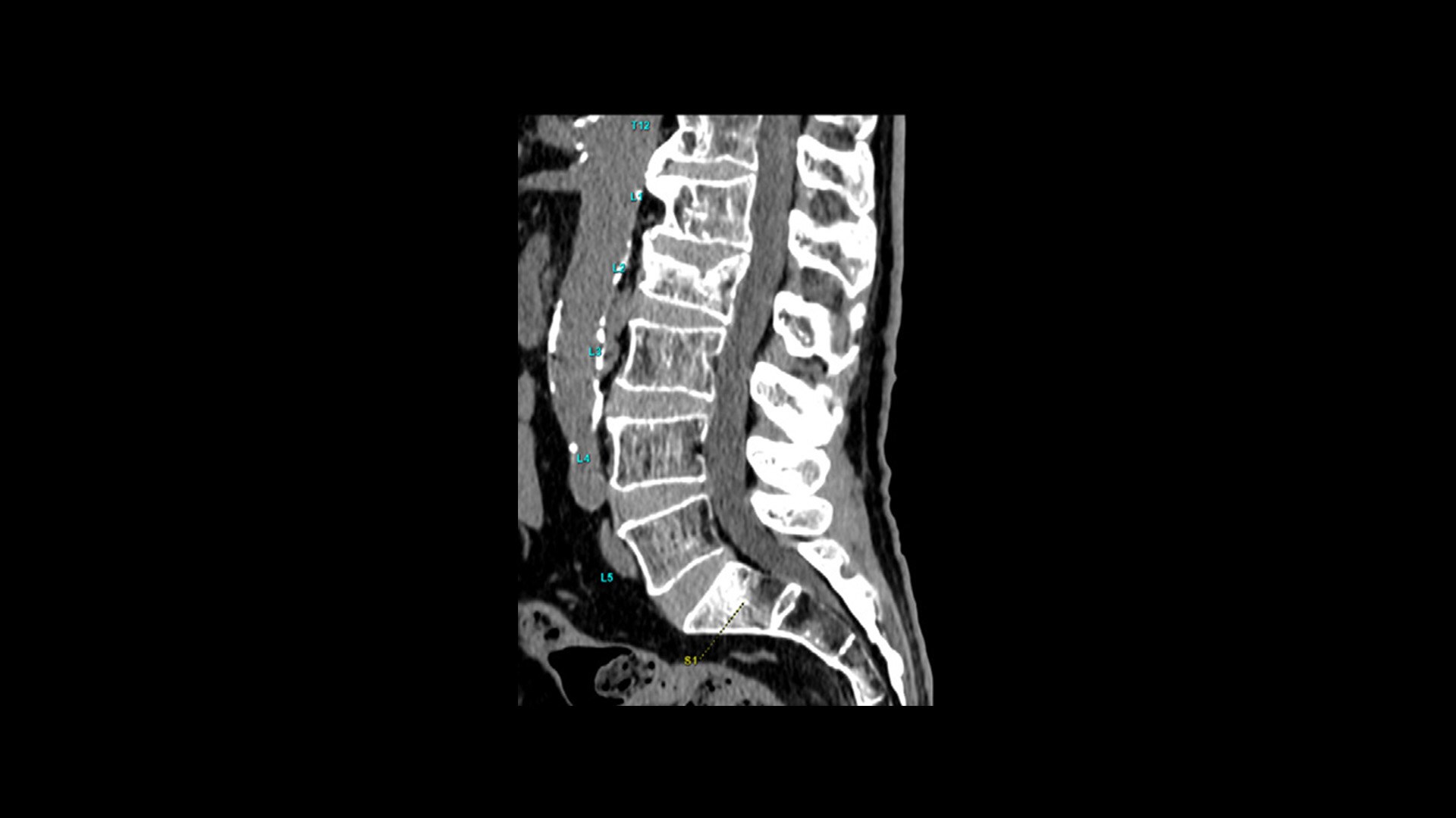 Product Media Carousel Image