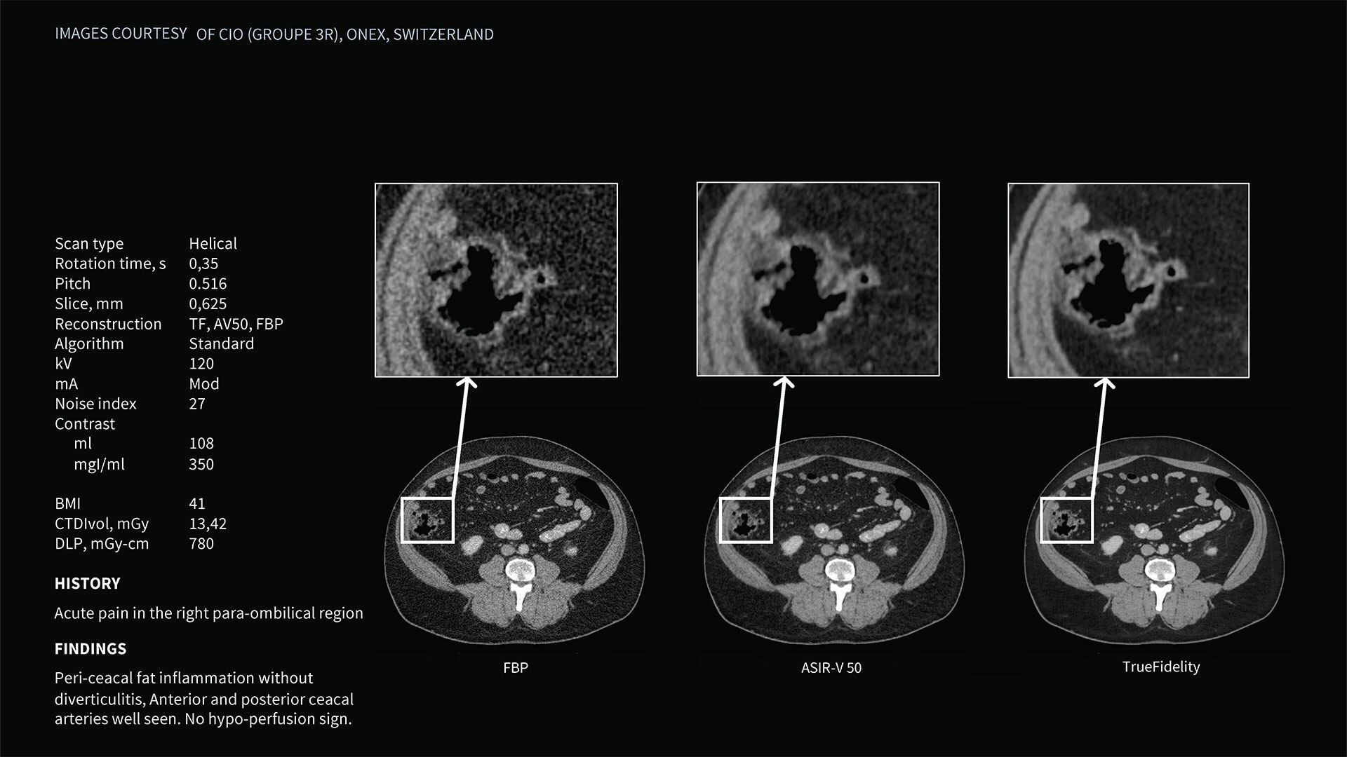 Product Media Carousel Image