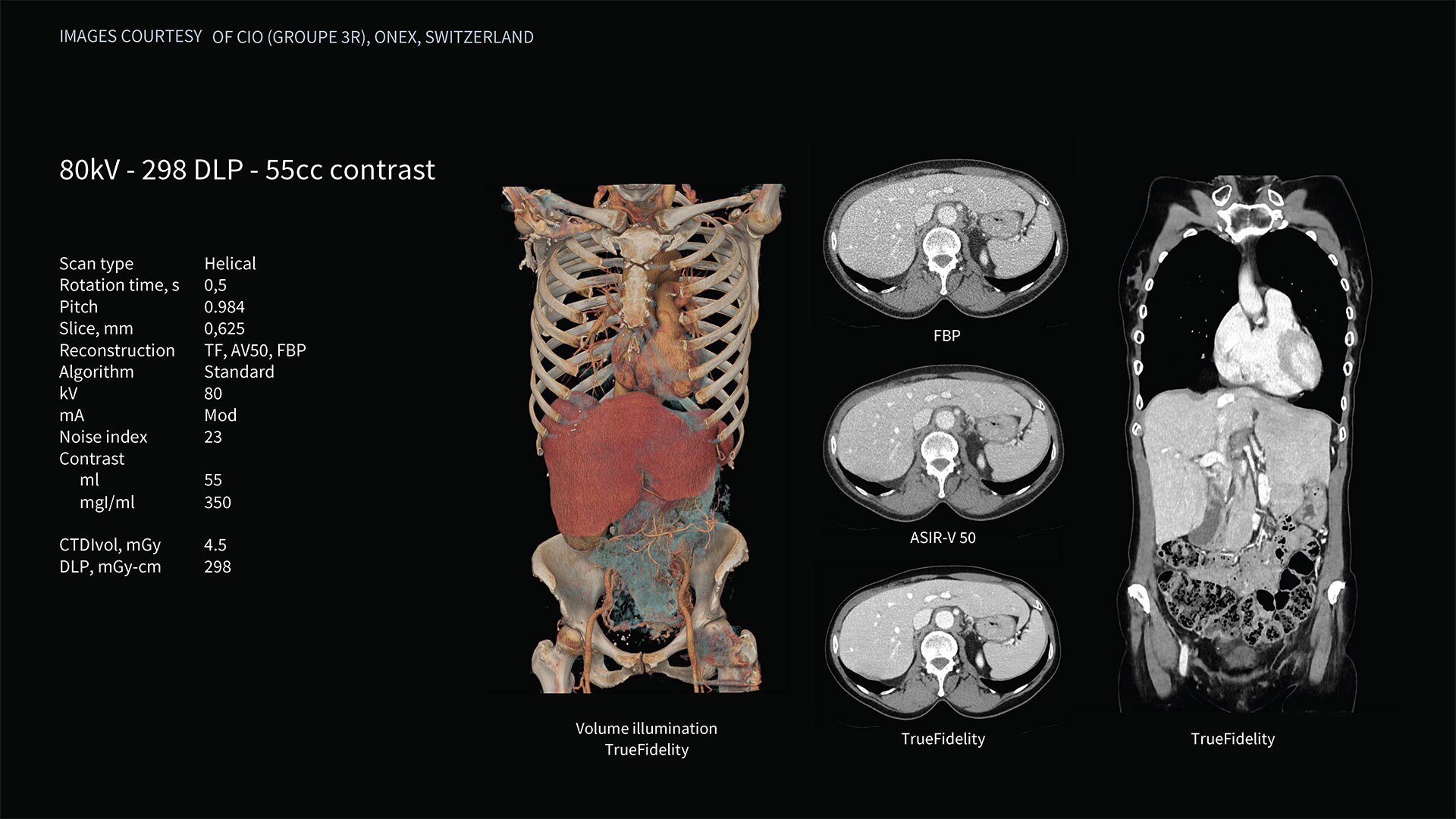 Product Media Carousel Image