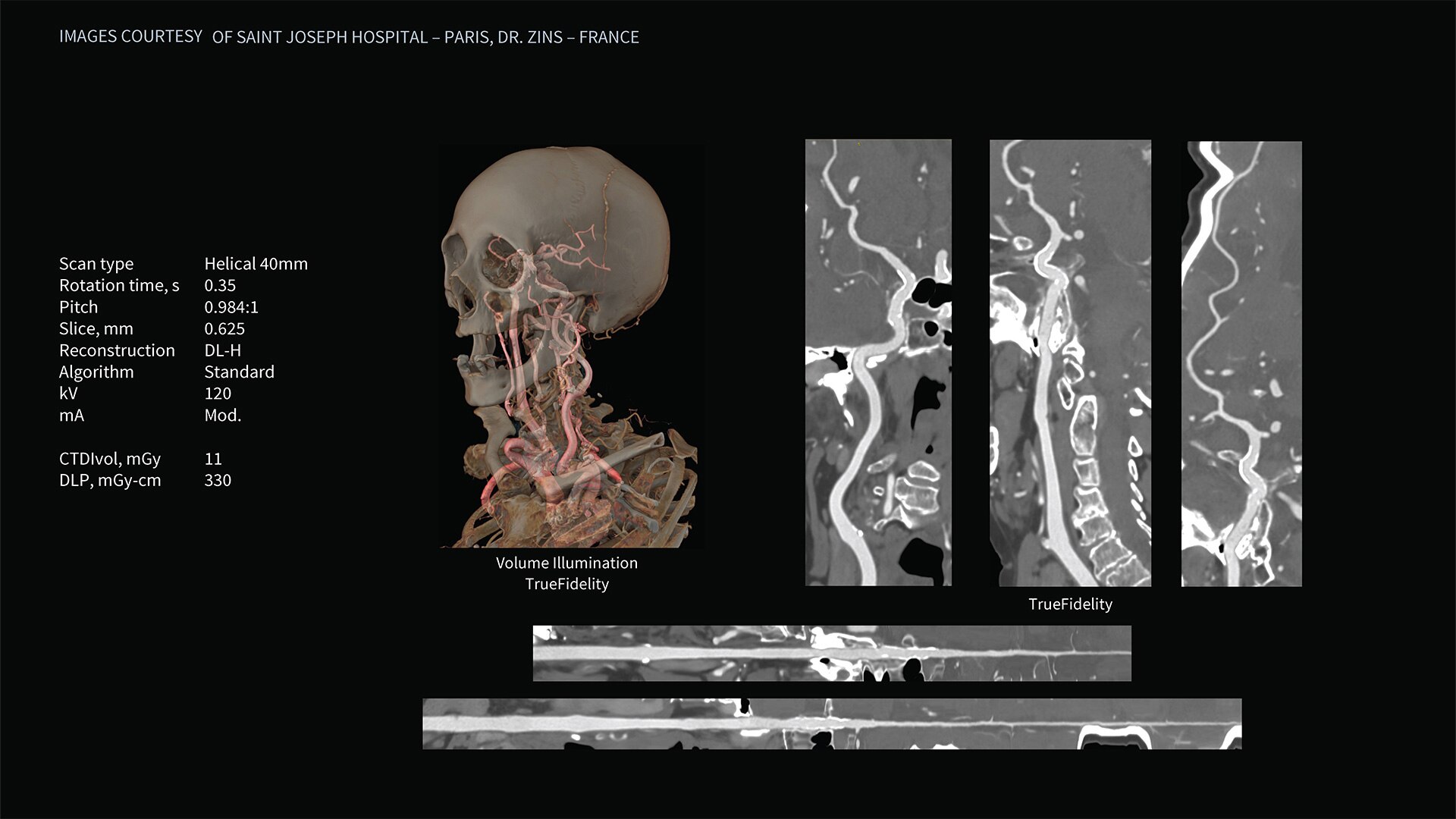 Product Media Carousel Image