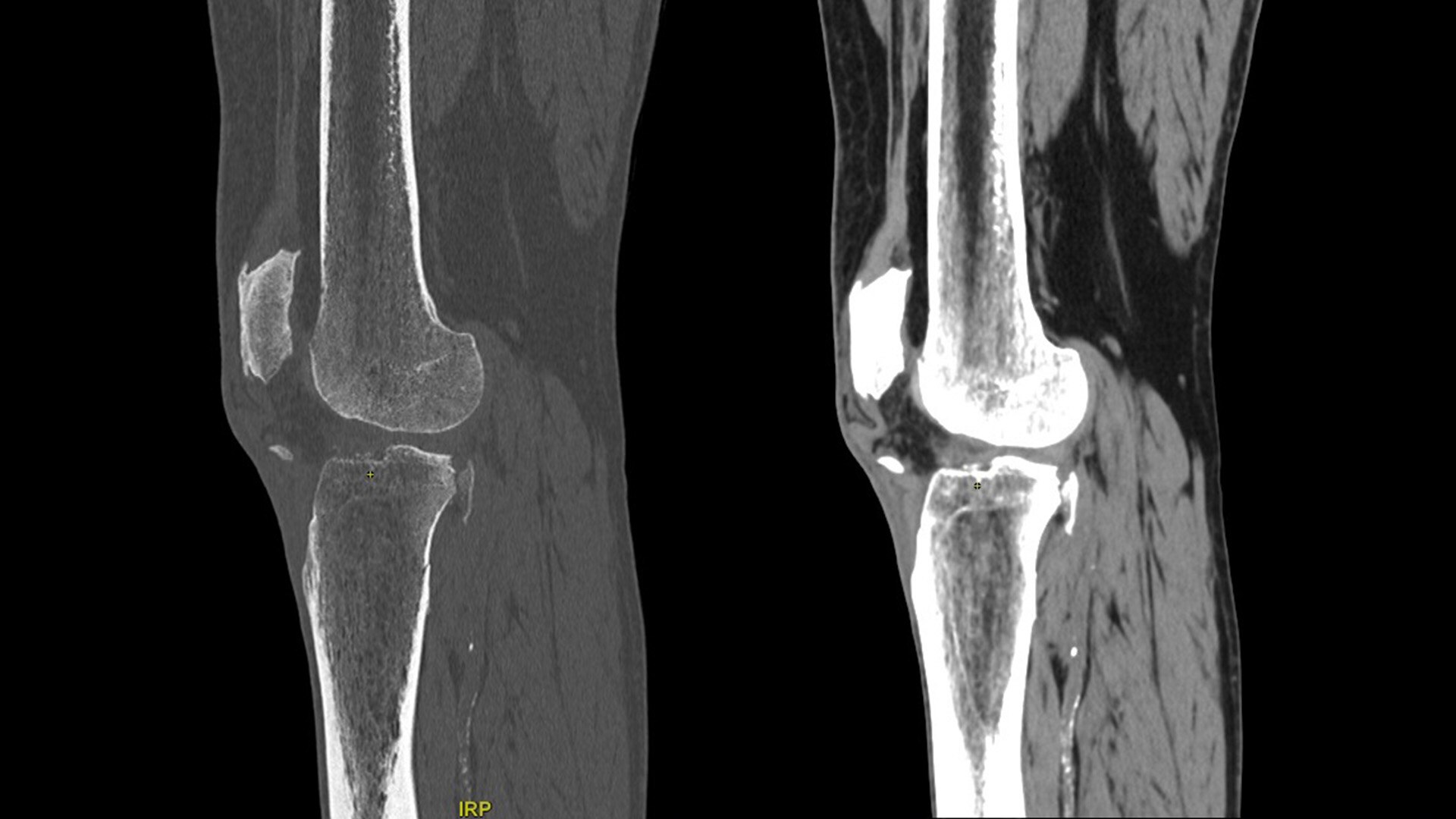 Product Media Carousel Image