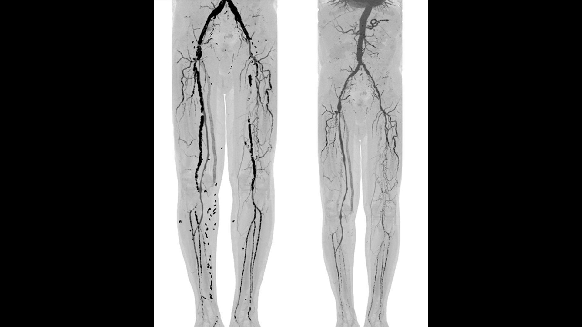 Product Media Carousel Image