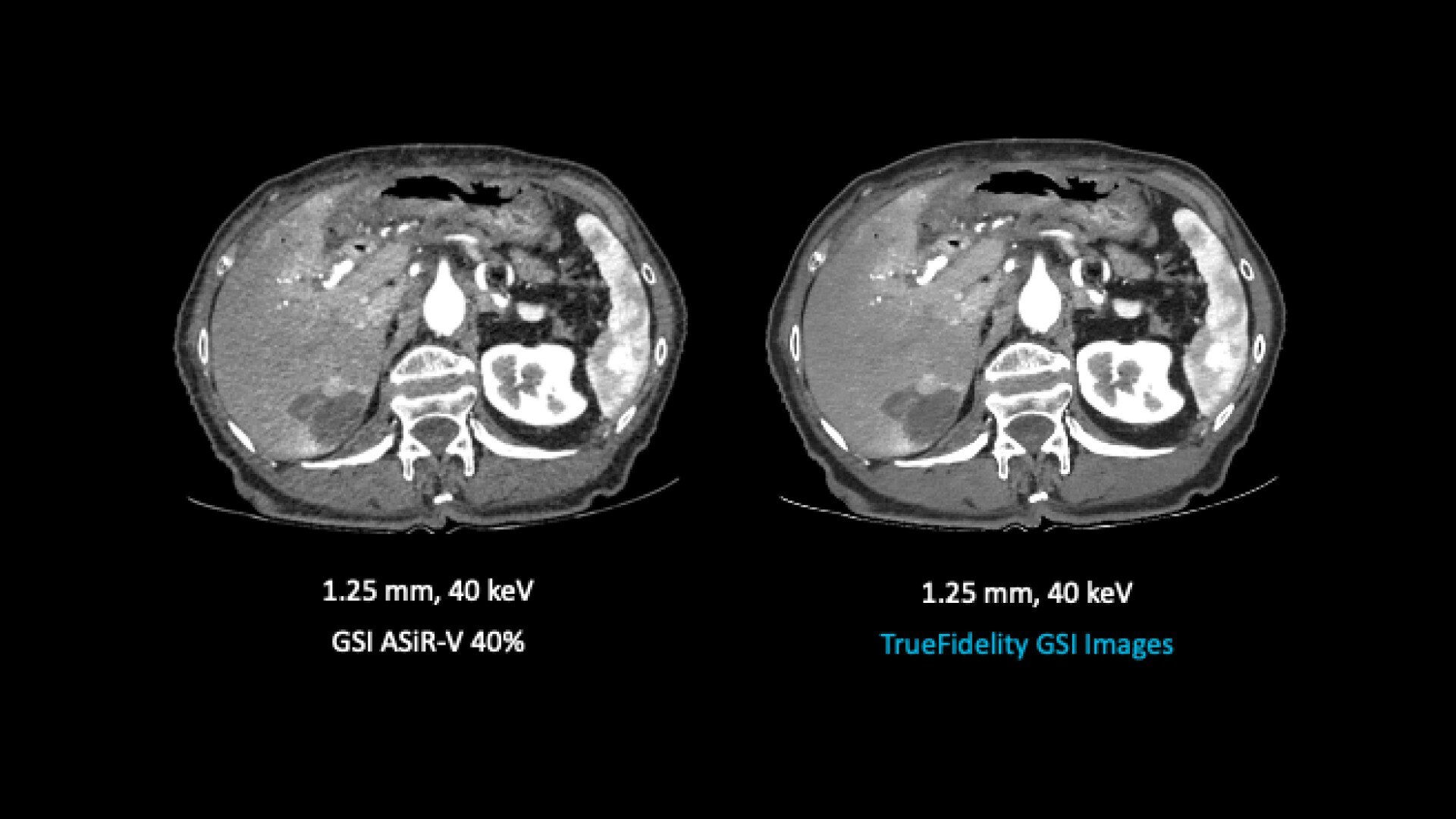 Product Media Carousel Image
